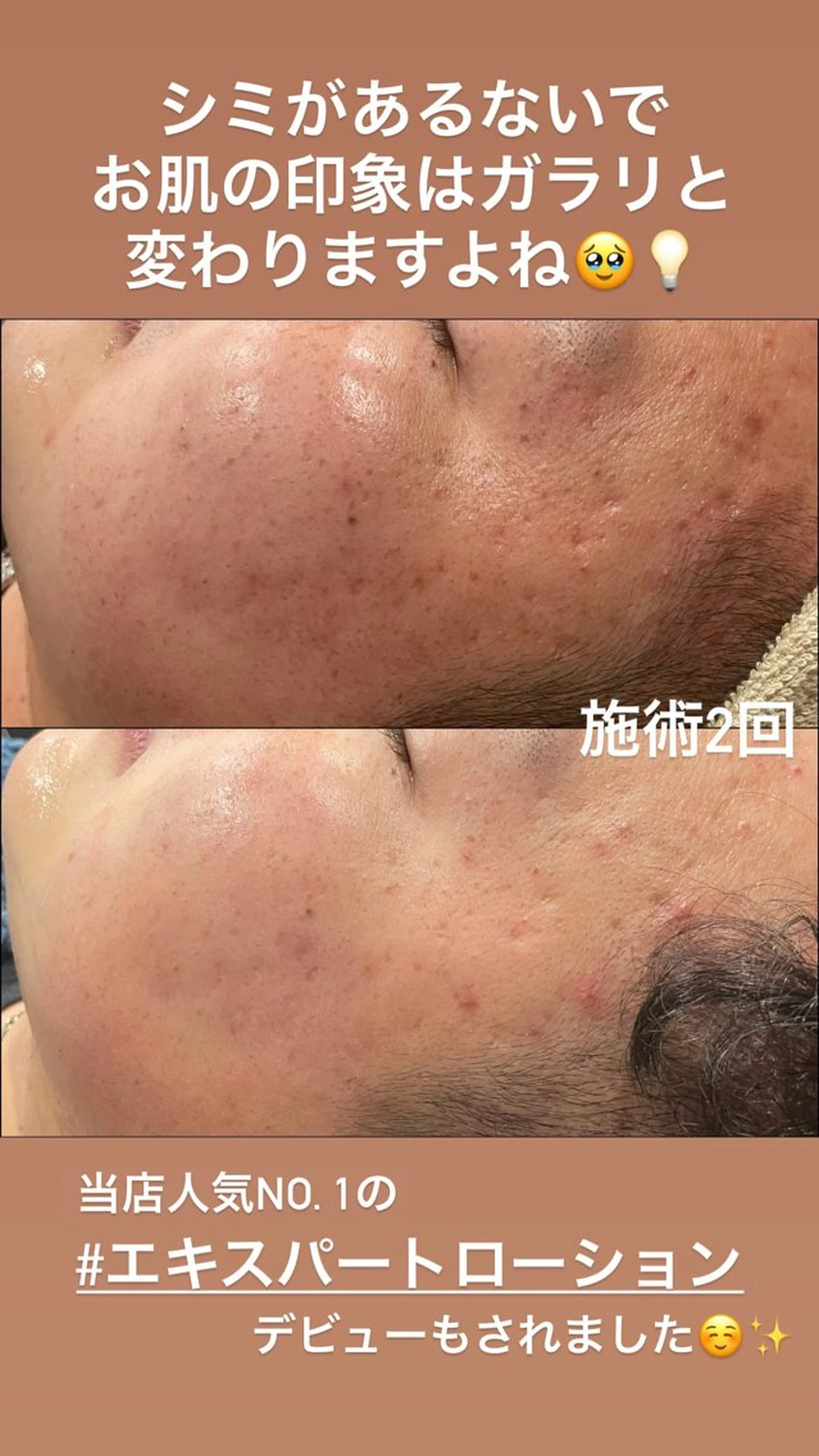 エステ LiZA エステティックサロンのエステ・リラクイメージ