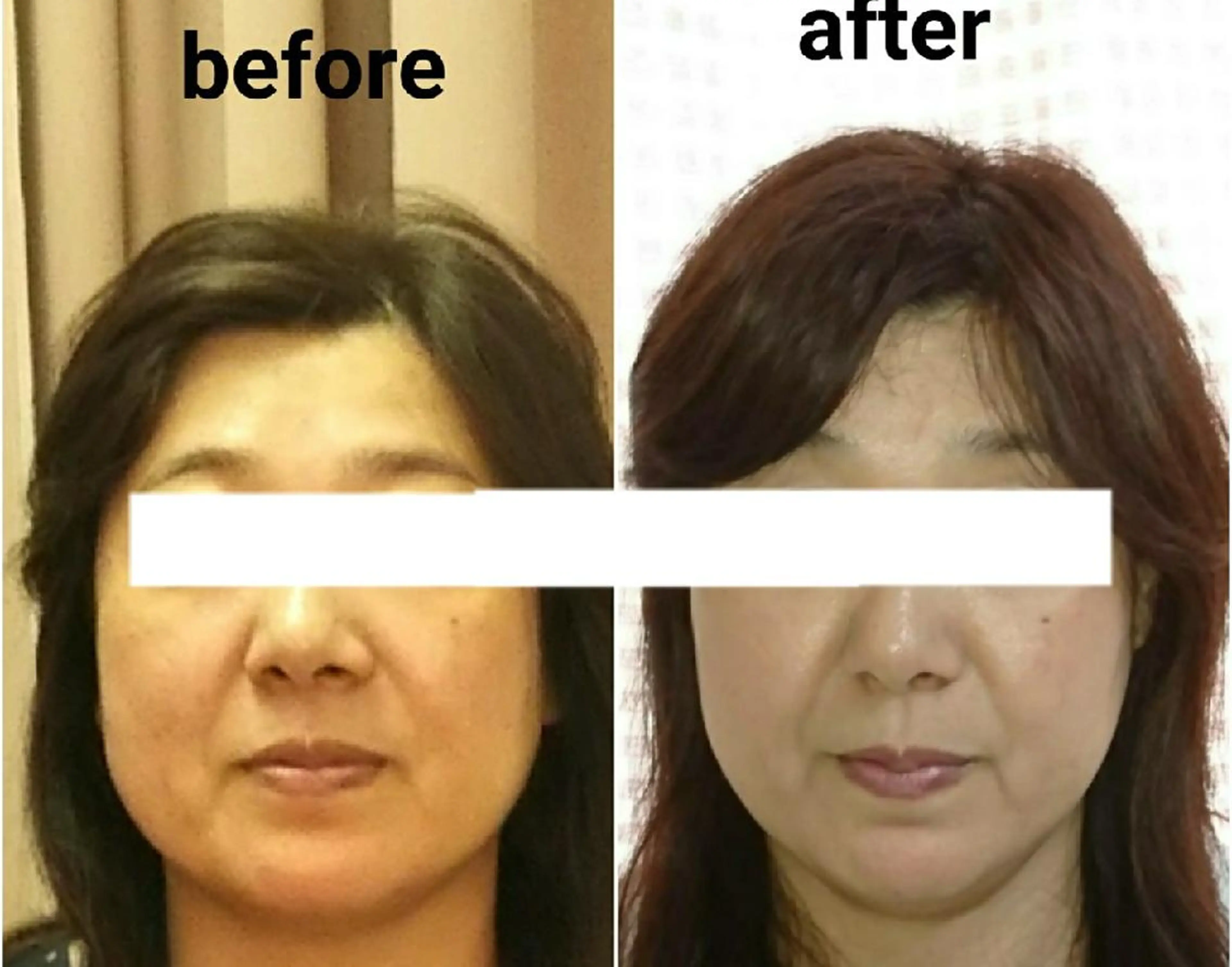 小顔と美肌 まごころエステMatoria所属・小顔 美肌専門 Matoriaのエステ・リラクイメージ