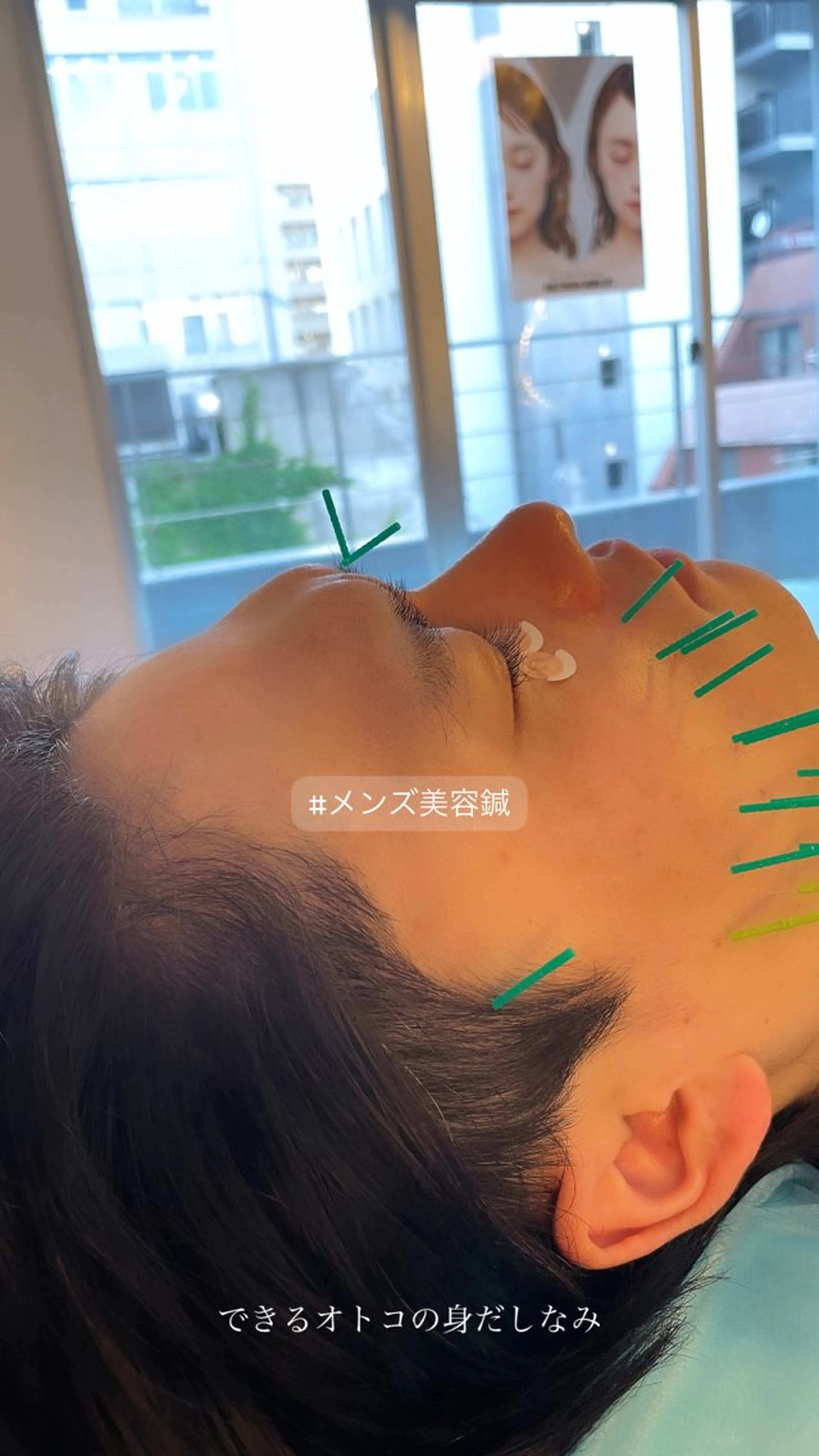 エステ リラク 小顔美容鍼専門サロン 渋谷YZのエステ・リラクイメージ