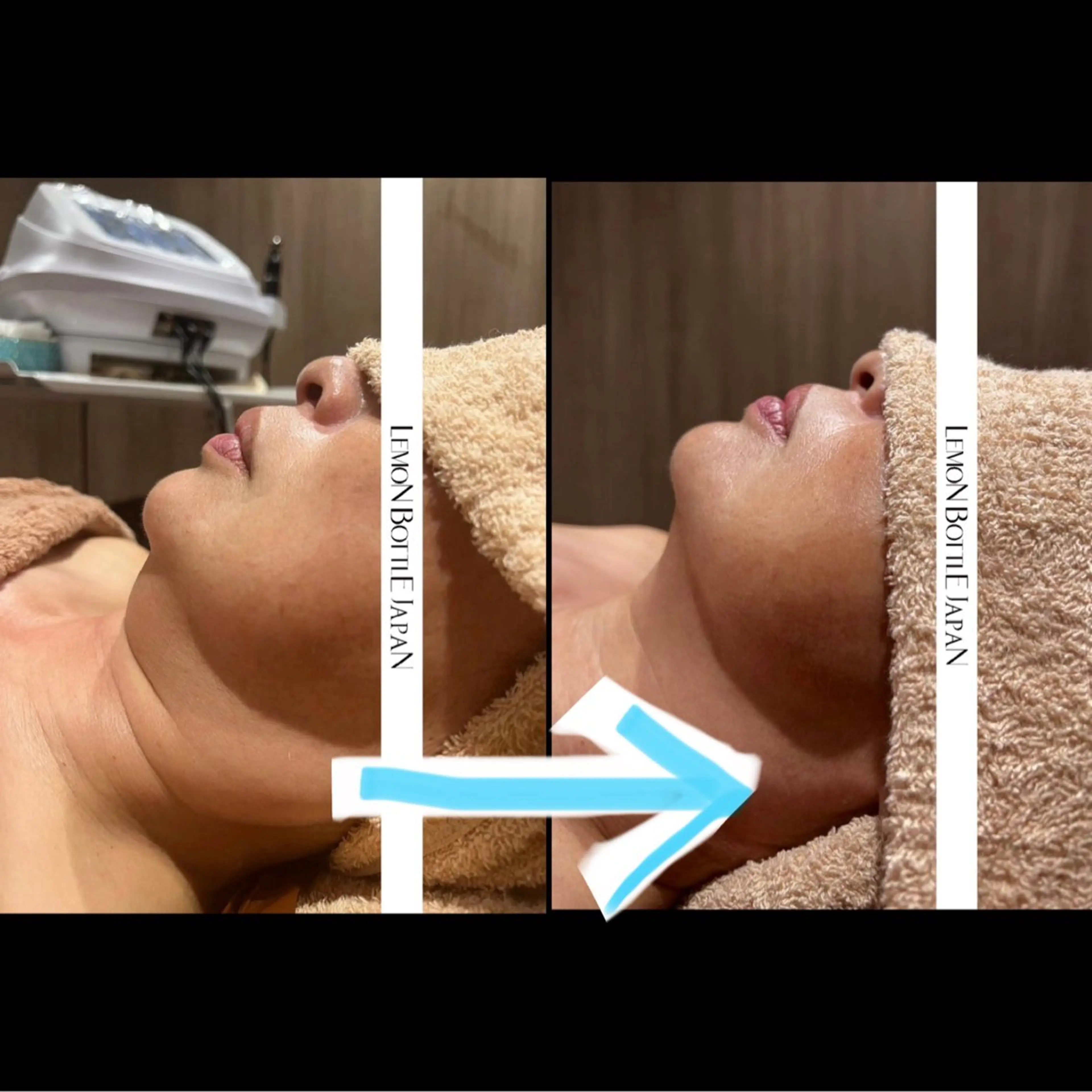 💐美肌/小顔づくり 🫧看護師🫧ASAのエステ・リラクイメージ