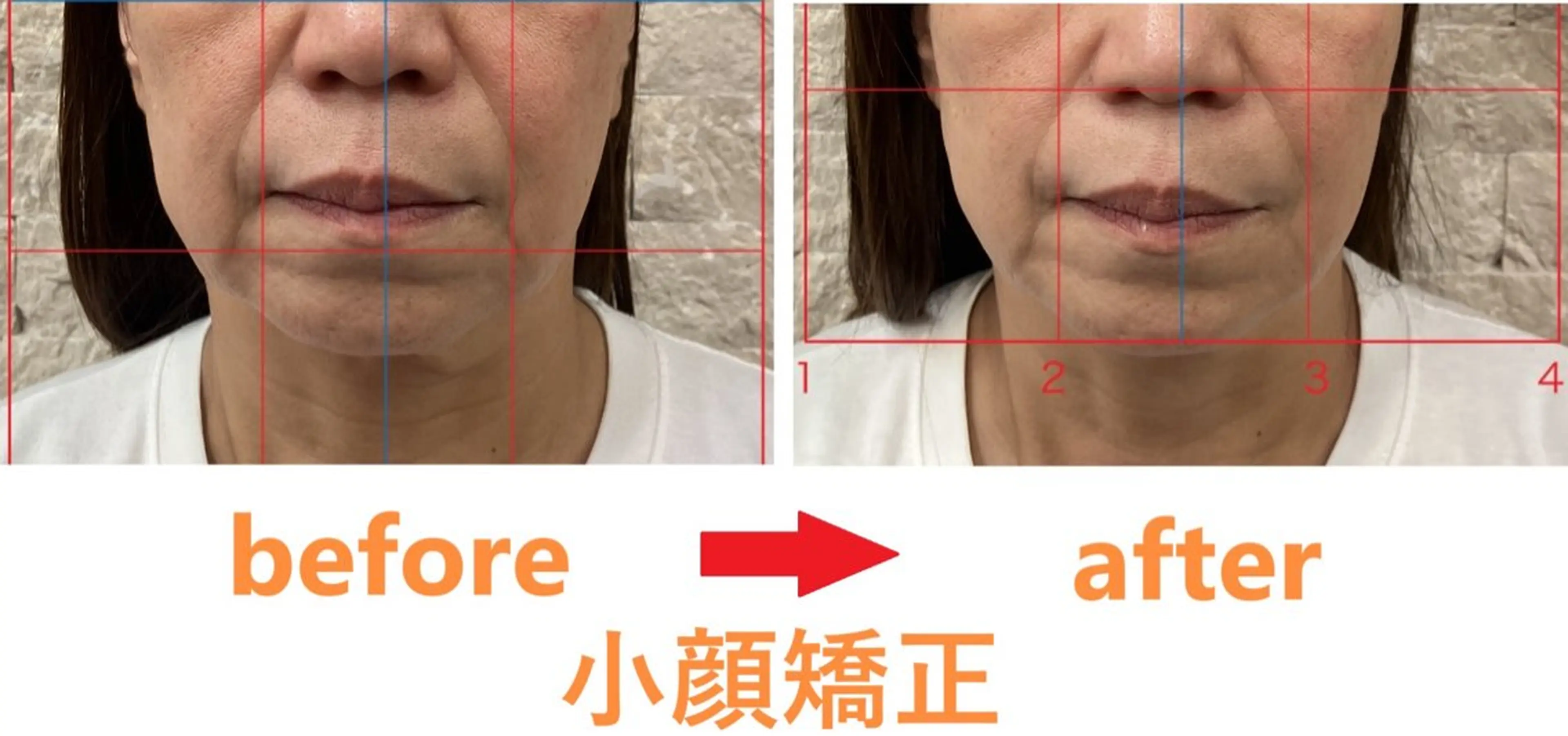 豊津BM整骨院所属・木田 明訓のエステ・リラクイメージ