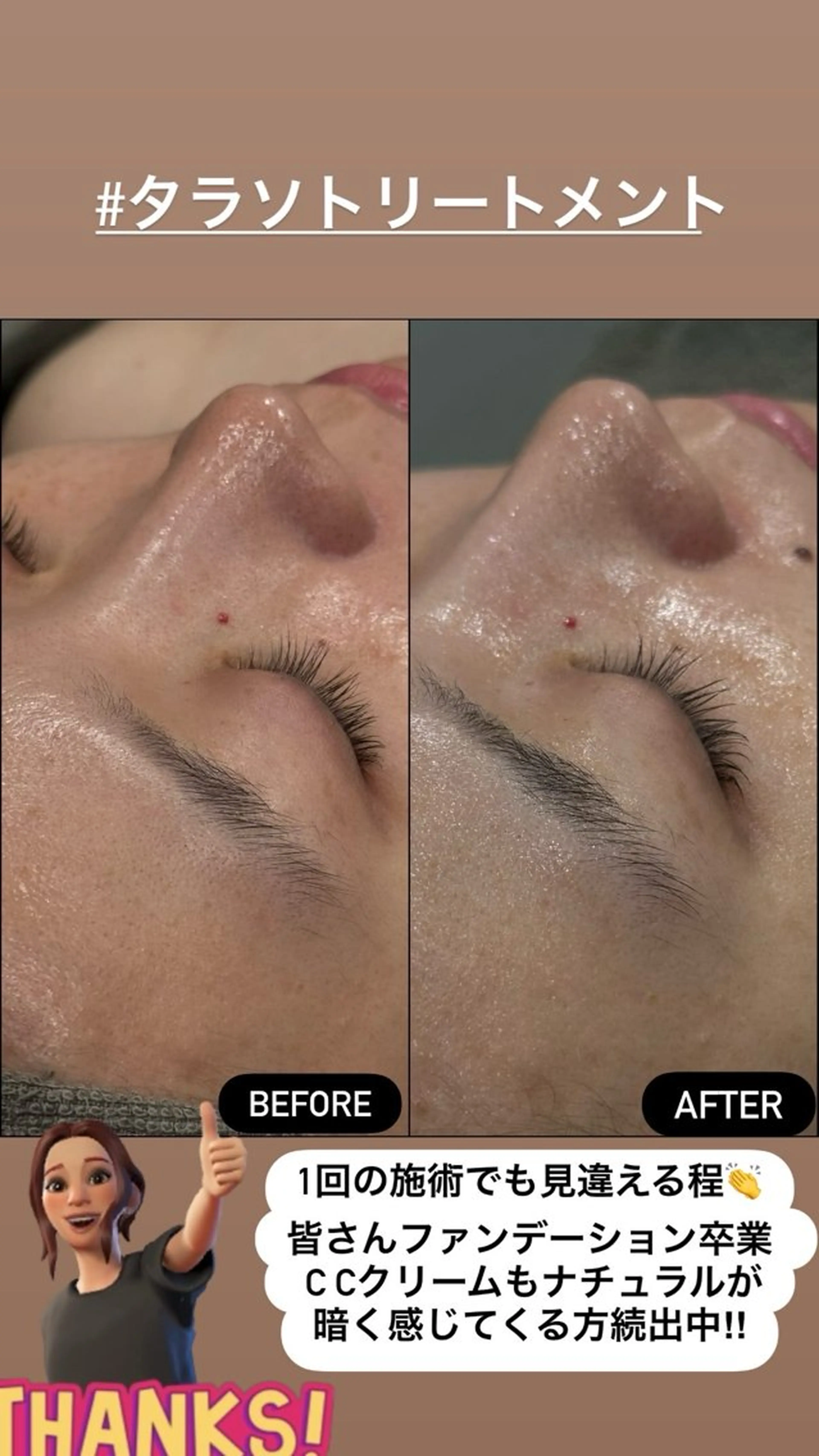 エステ LiZA エステティックサロンのエステ・リラクイメージ