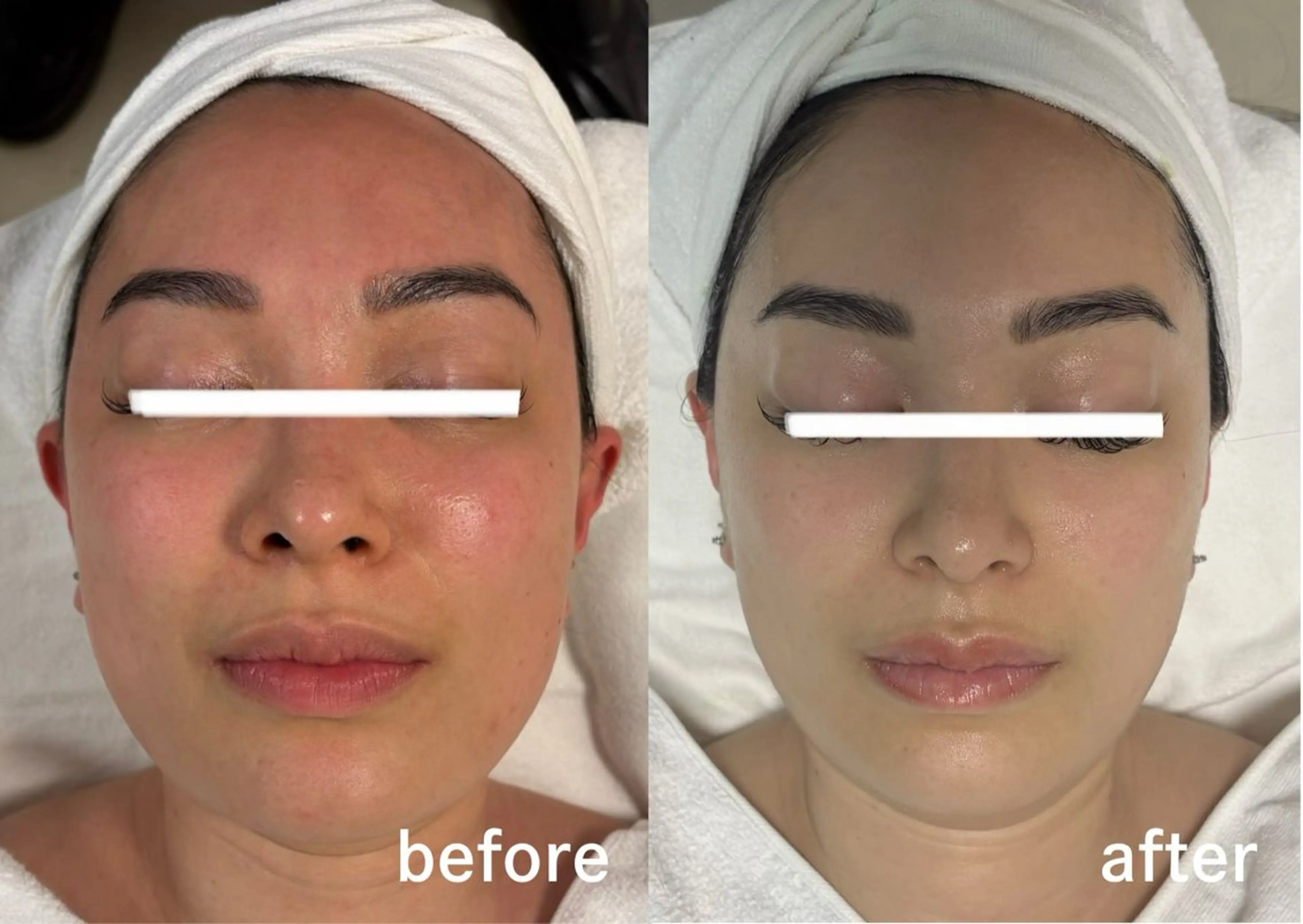 スキンケアサロン　デディア所属・米谷🎀 デディア恵比寿🪞✨のエステ・リラクイメージ