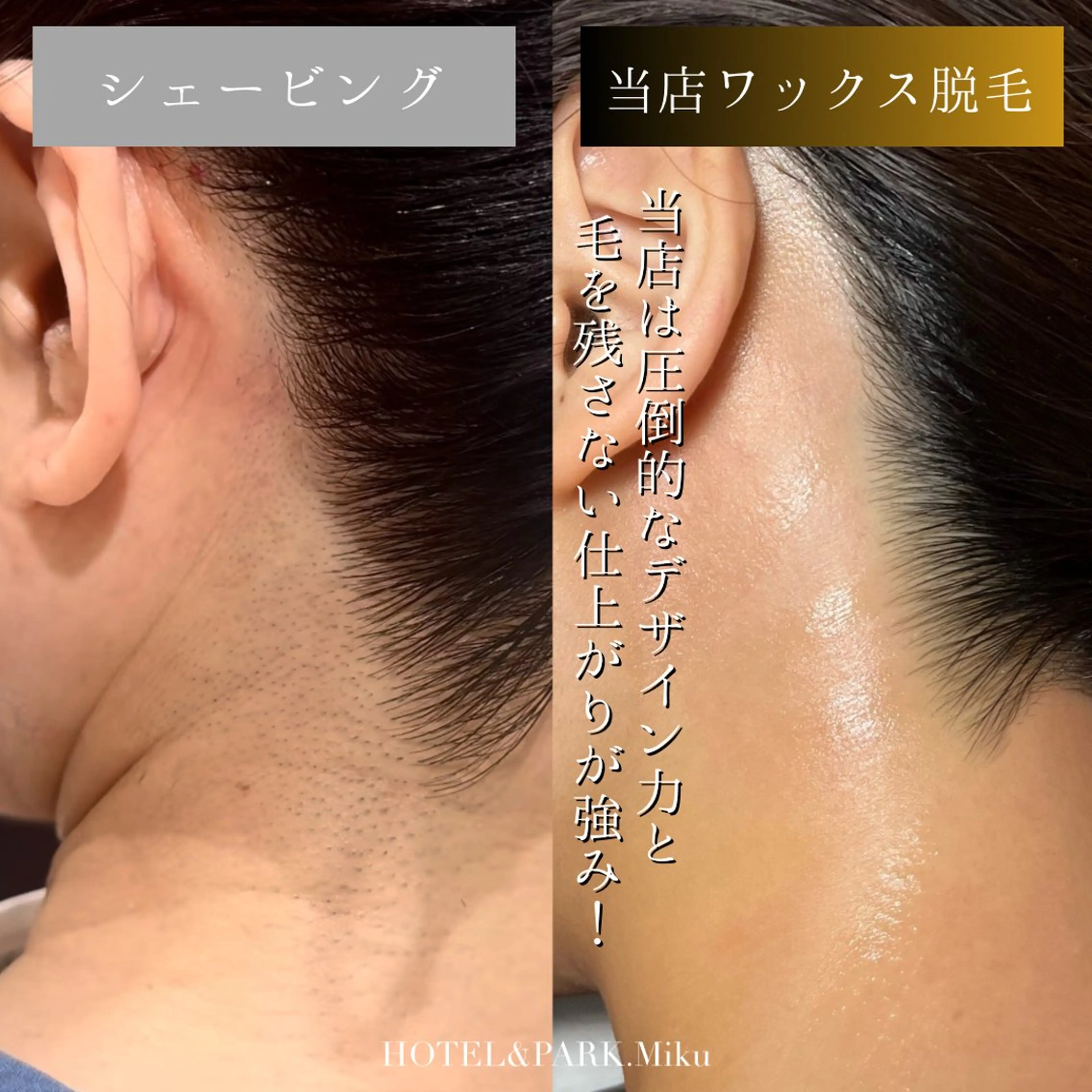 脱毛 HOTEL&PARK Mikuワックス脱毛のエステ・リラクイメージ