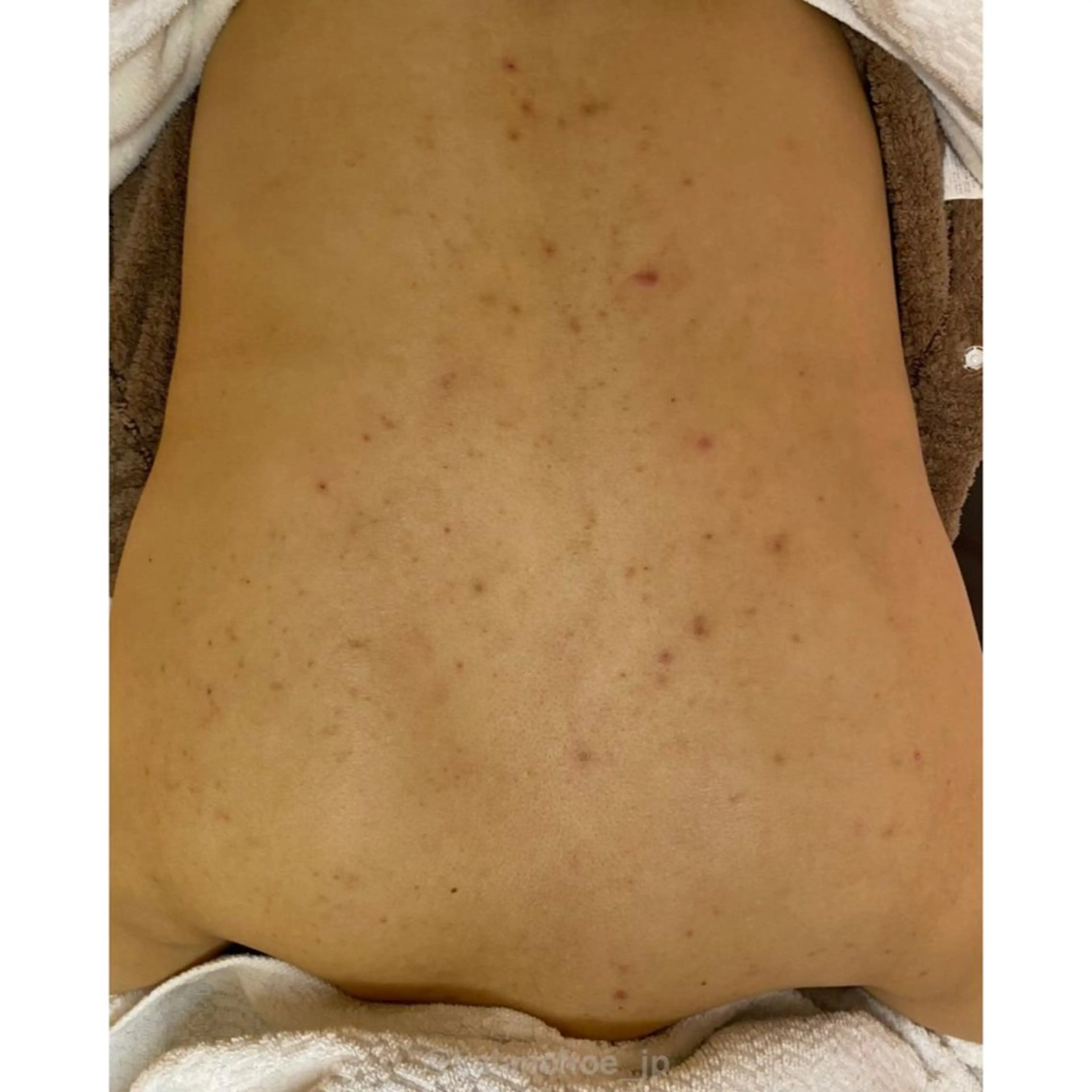 エステ リラク 肌質改善 KALANCHOEのエステ・リラクイメージ