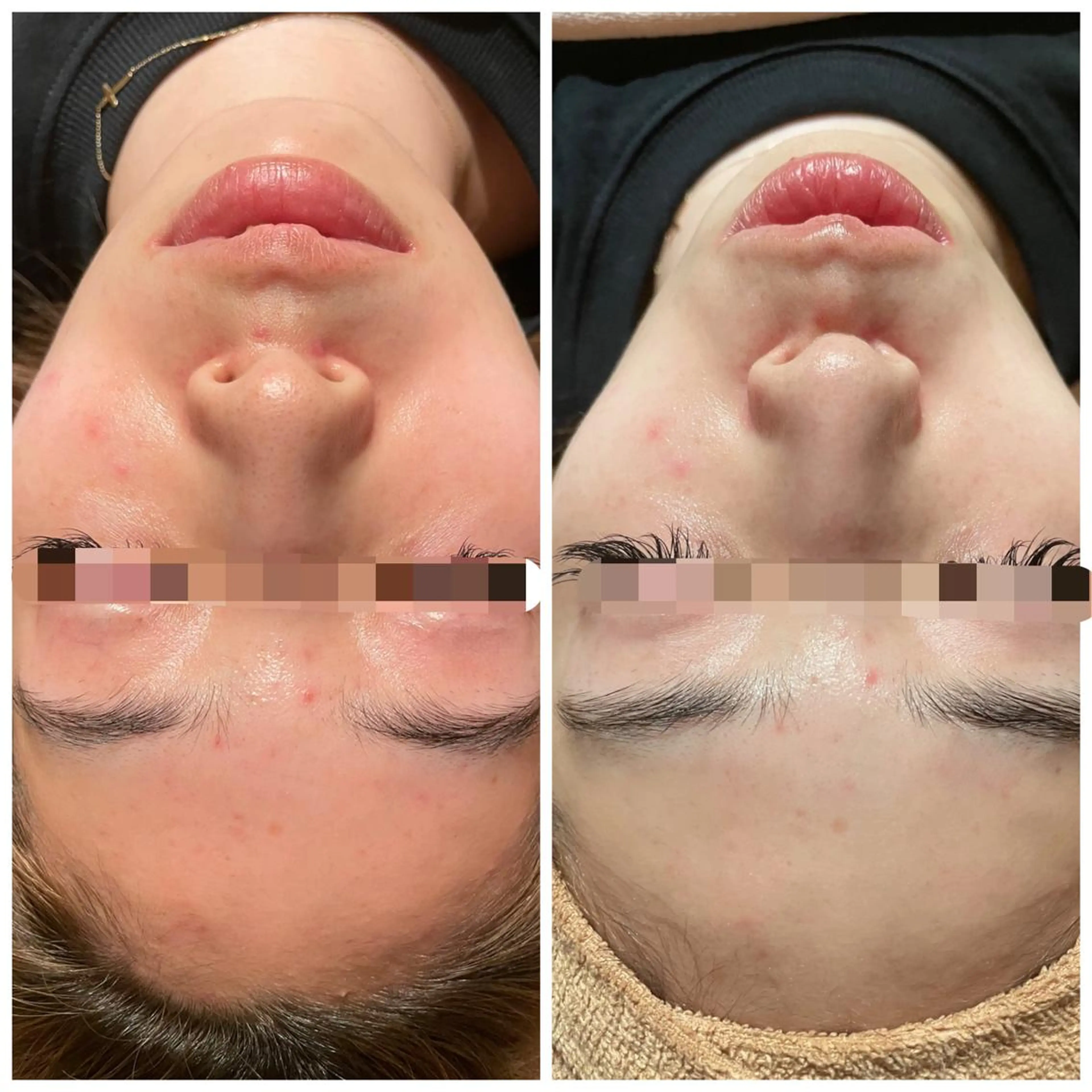 エステ Shelly Graceのエステ・リラクイメージ