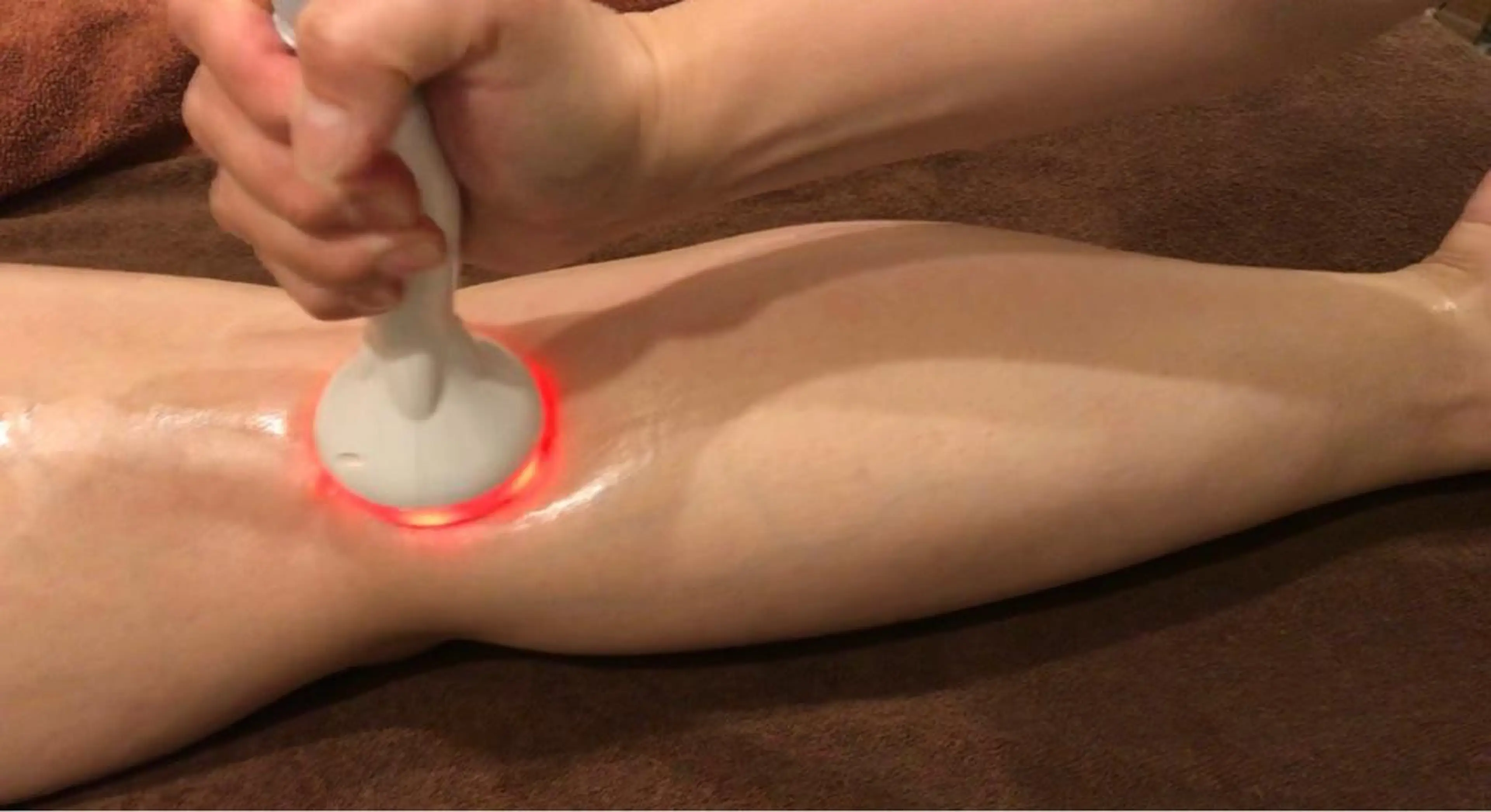 1日3名様限定!太もものセルライトケア!むくみ改善!の写真