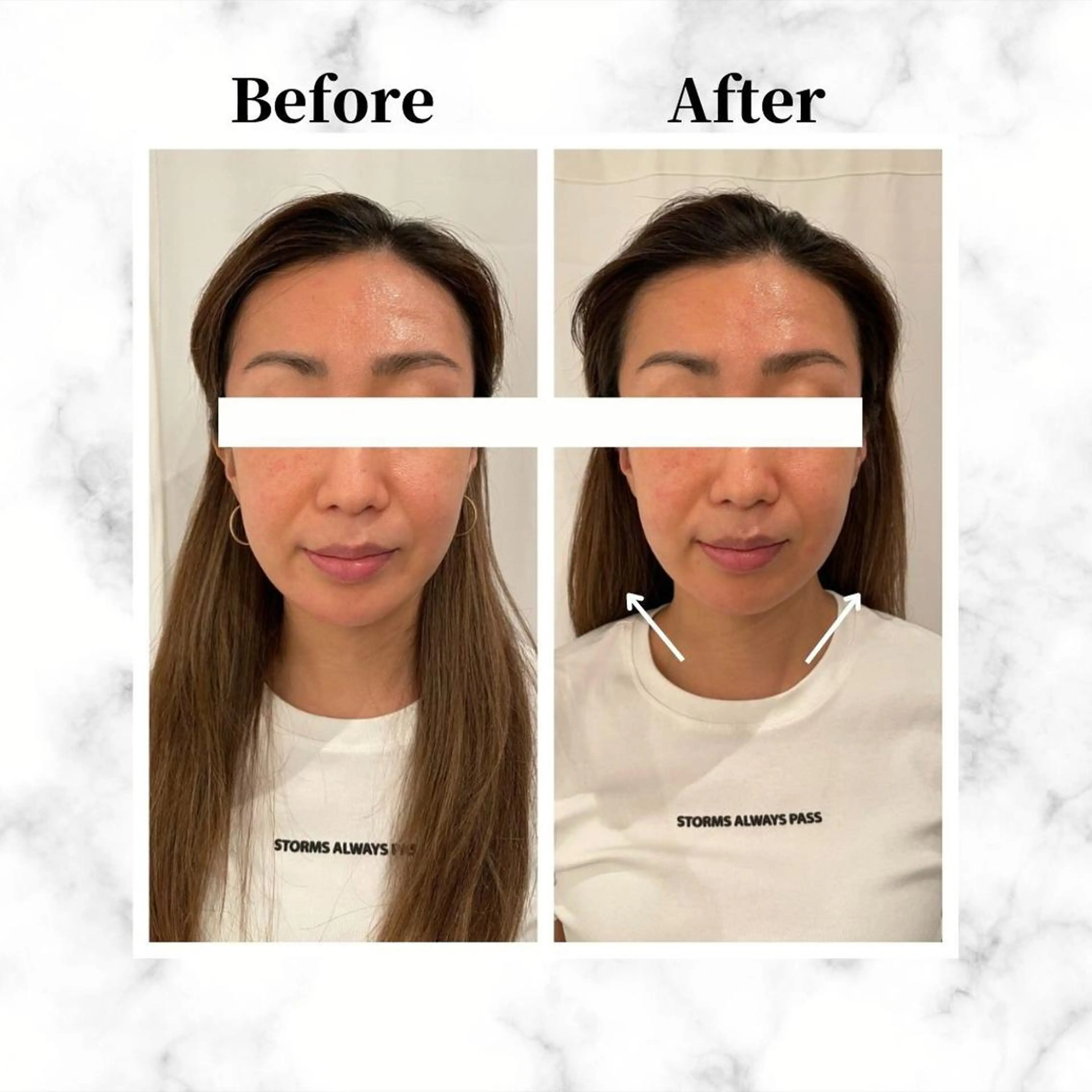 エステ リラク 12Dハイフ💗 最強小顔のエステ・リラクイメージ