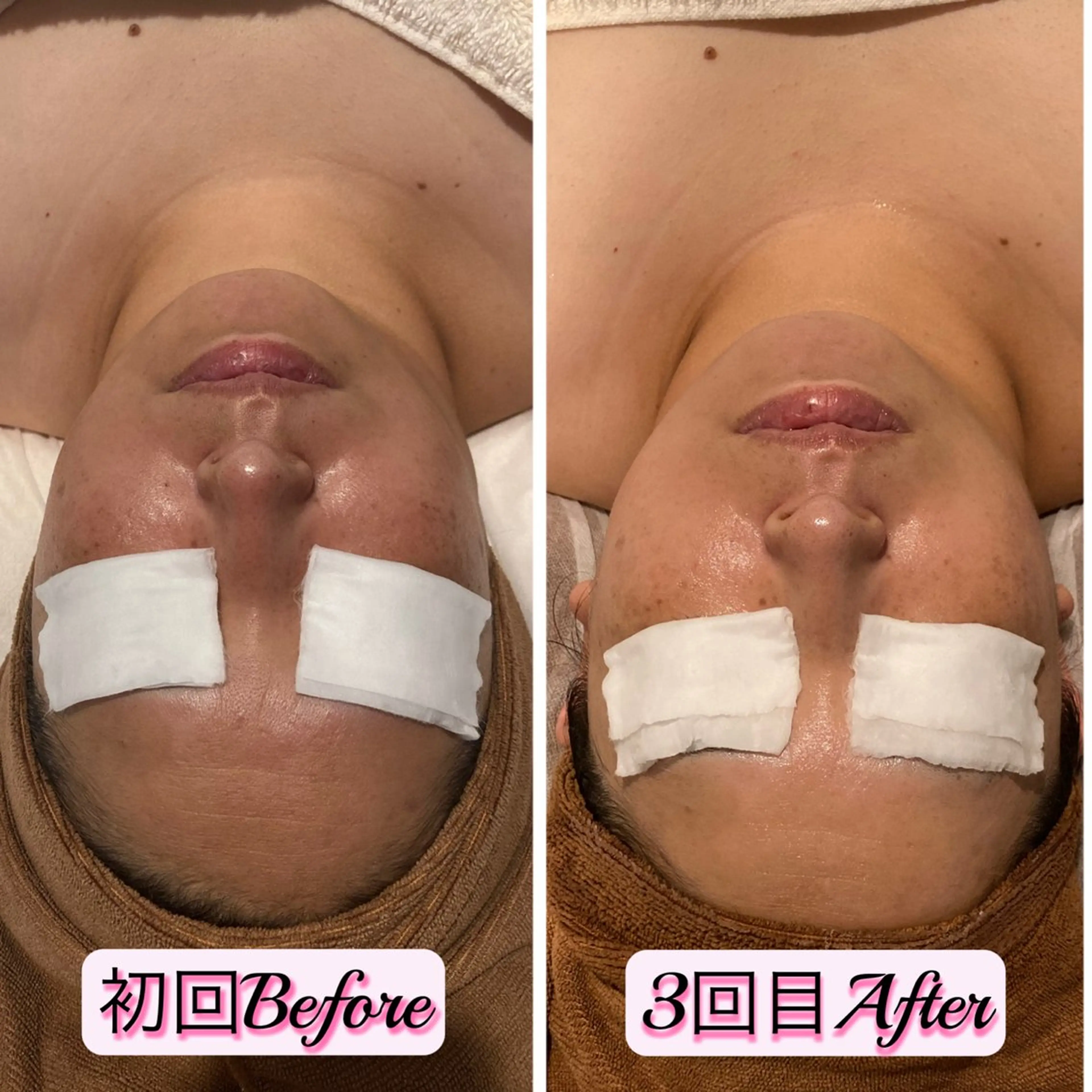 エステ SA KIのマツエク・マツパデザイン