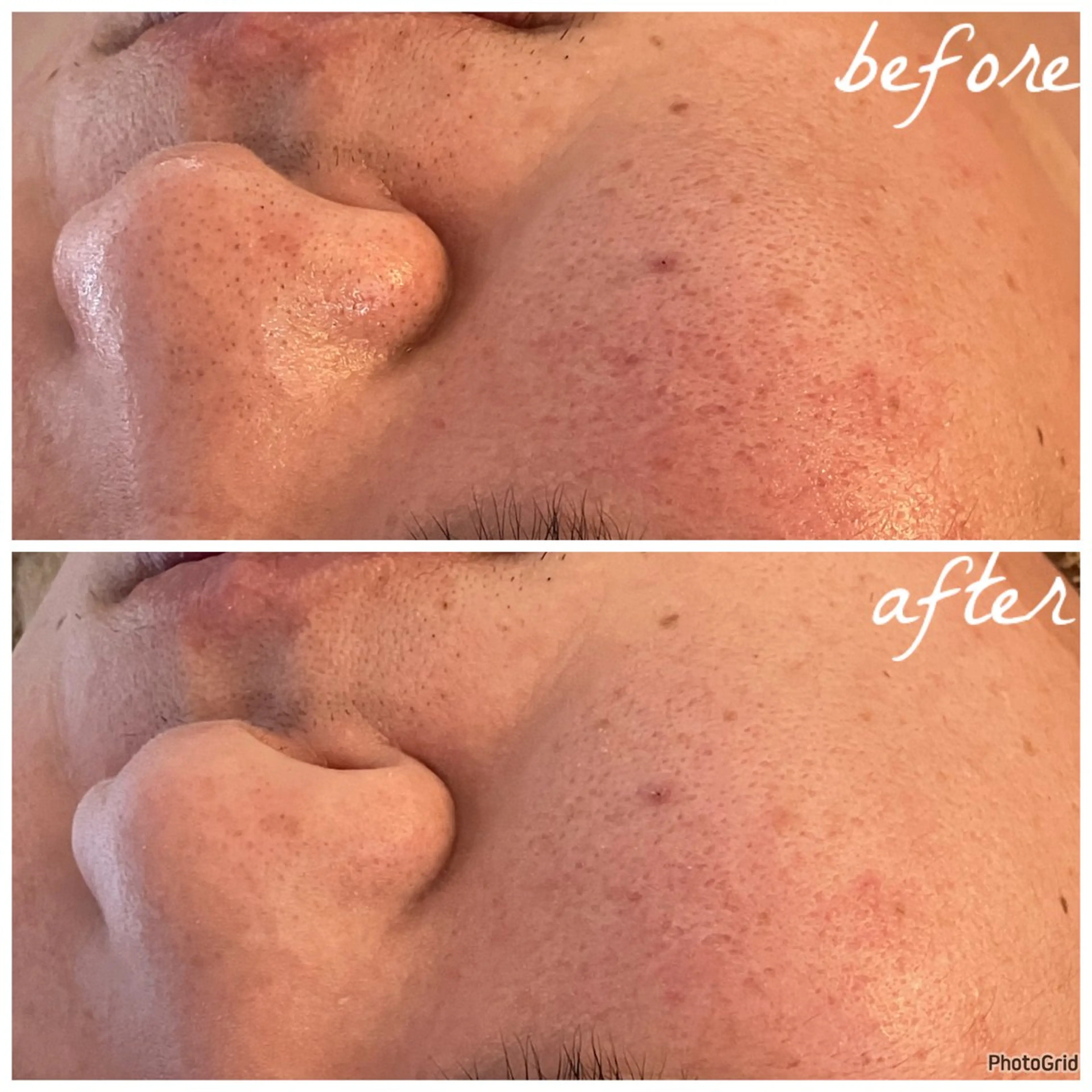 メンズ エステ メナード岐阜茜部 杉浦のエステ・リラクイメージ