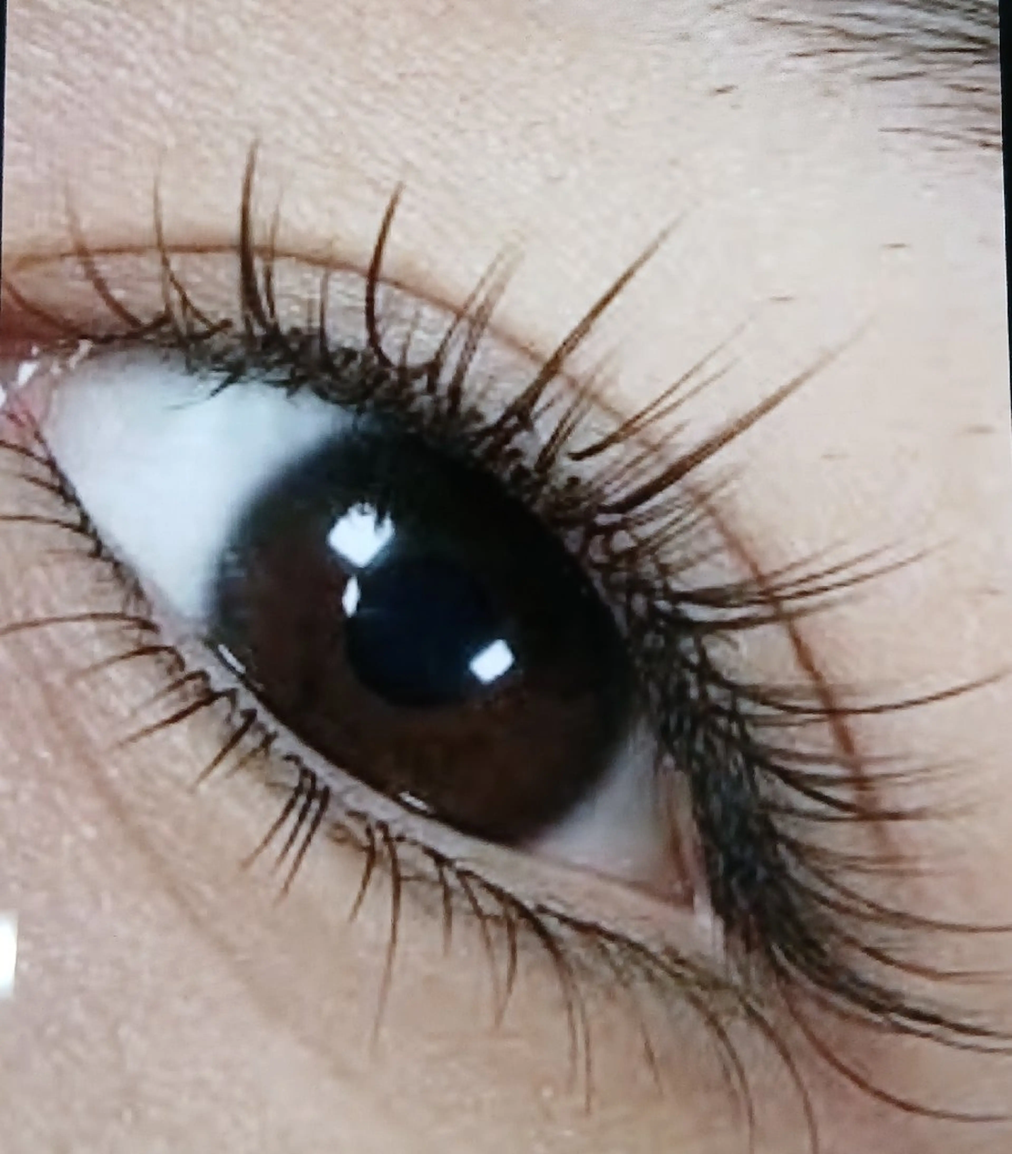 フラットラッシュ100本の写真