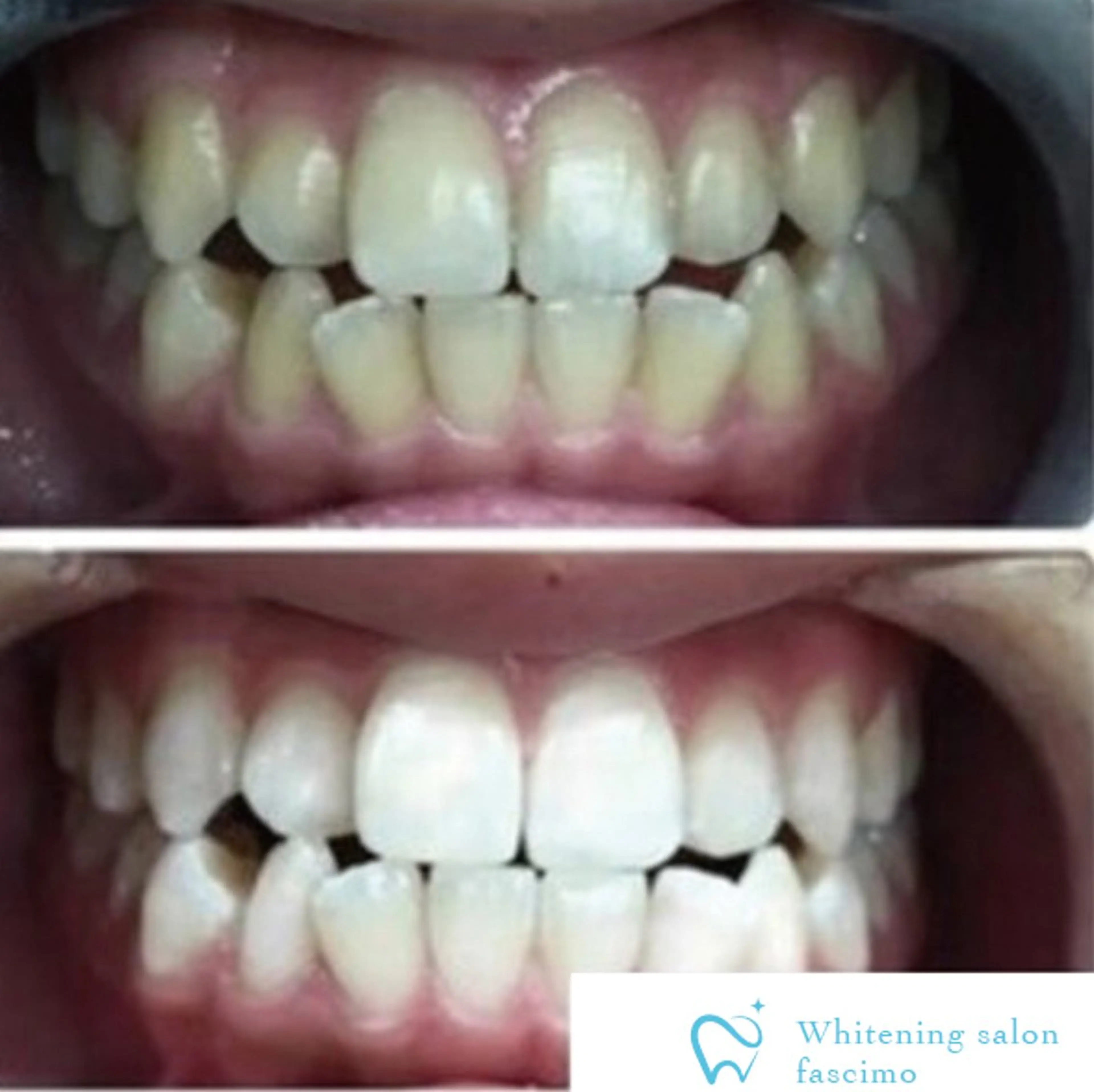 セルフホワイトニングサロンfascimo所属・ホワイトニングサロン fascimo新座店のその他イメージ