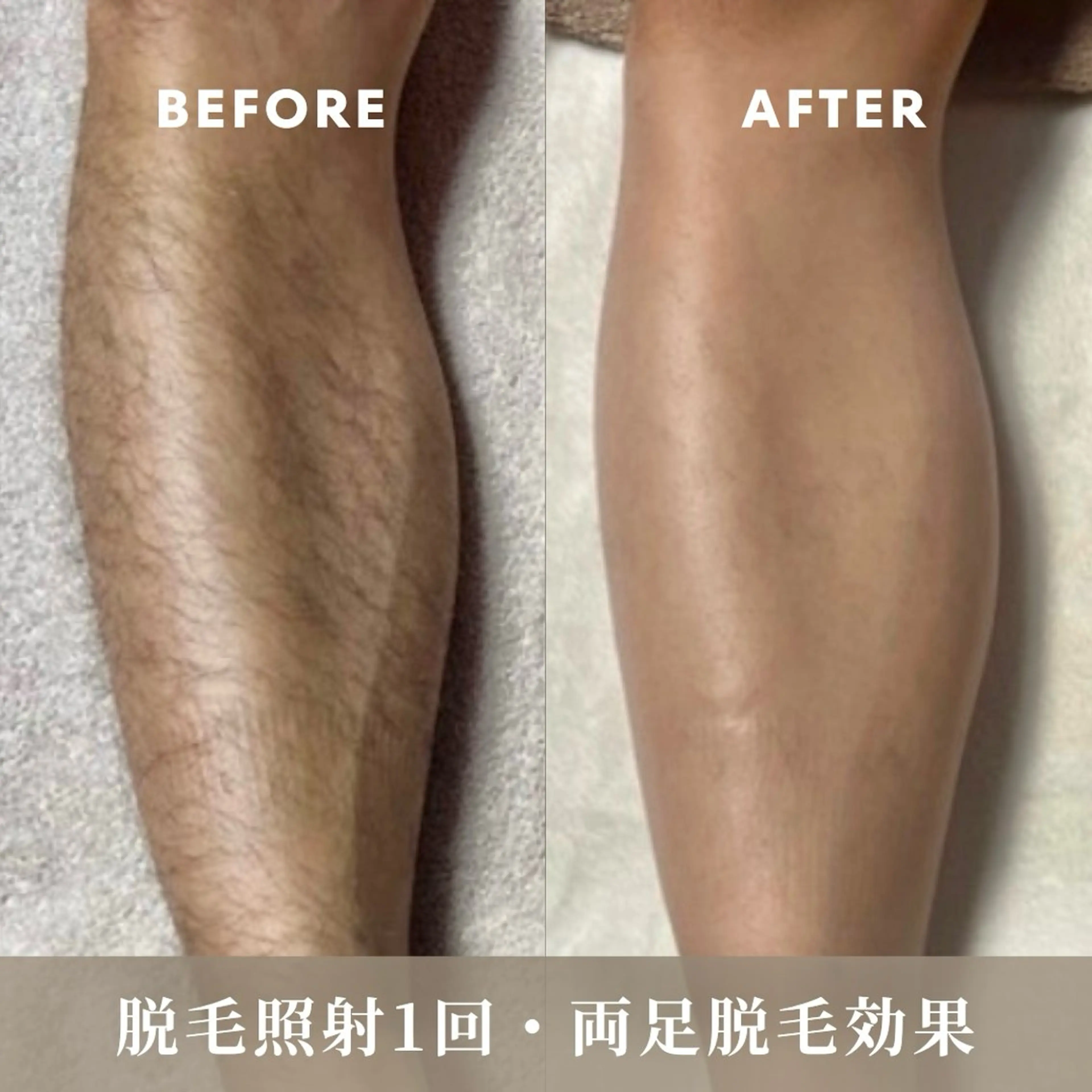 メンズ キッズ 脱毛しま専科 宗右衛門町店のエステ・リラクイメージ