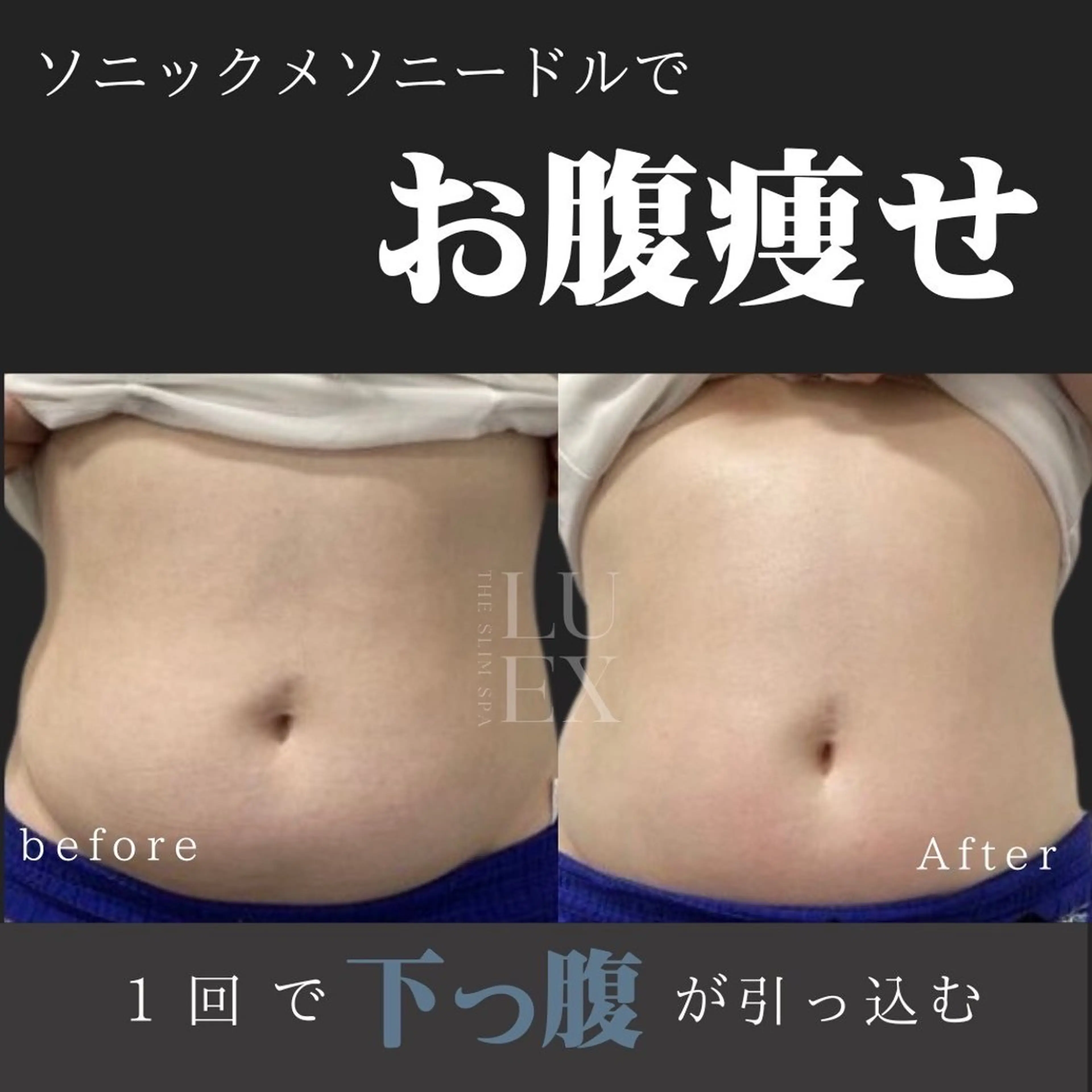 痩身専門サロン Saoriのエステ・リラクイメージ