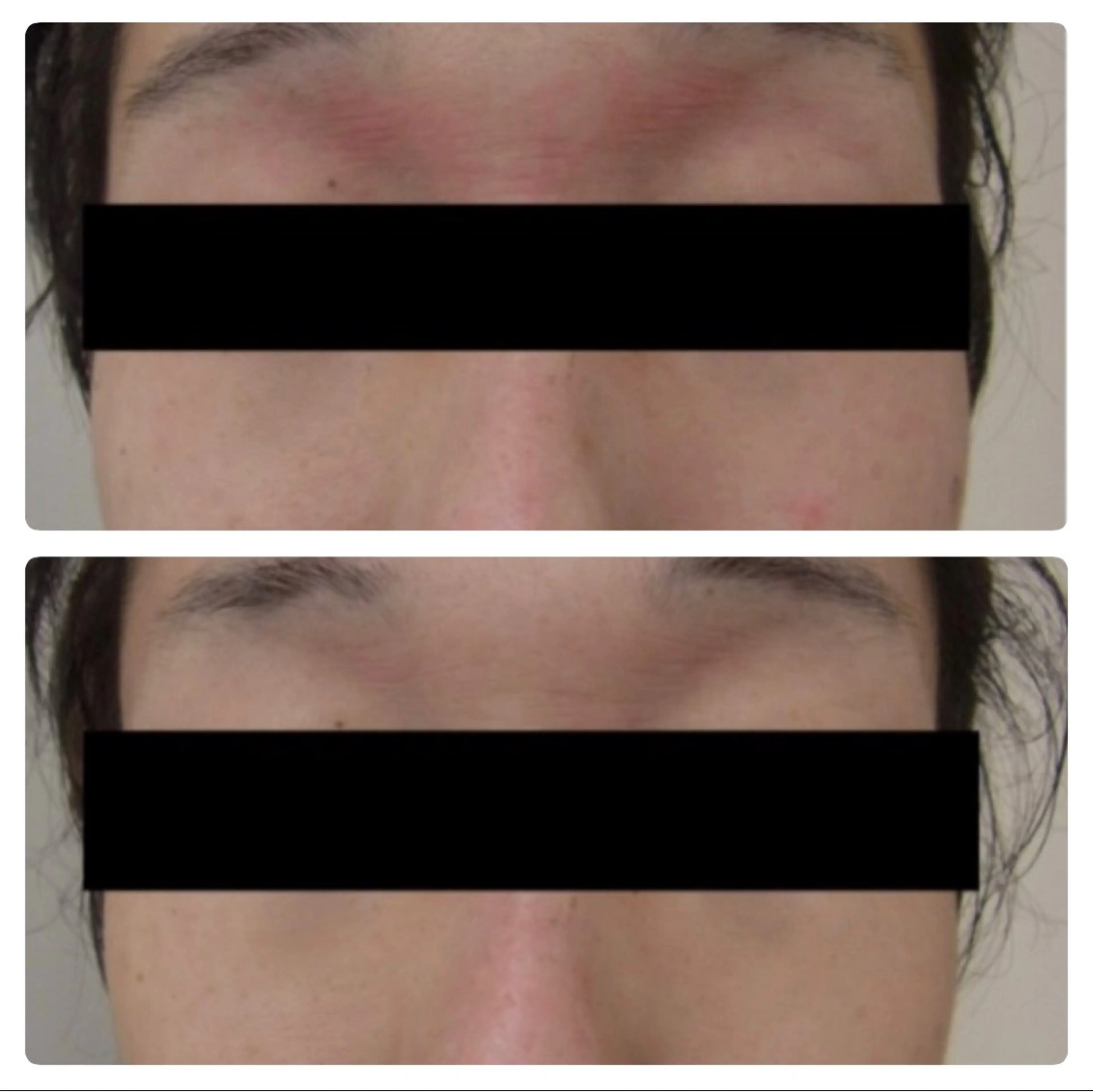 メンズ◎【乾燥・敏感肌でお悩みの方】肌診断+適切な洗顔+鎮静・保湿コース　90分の写真