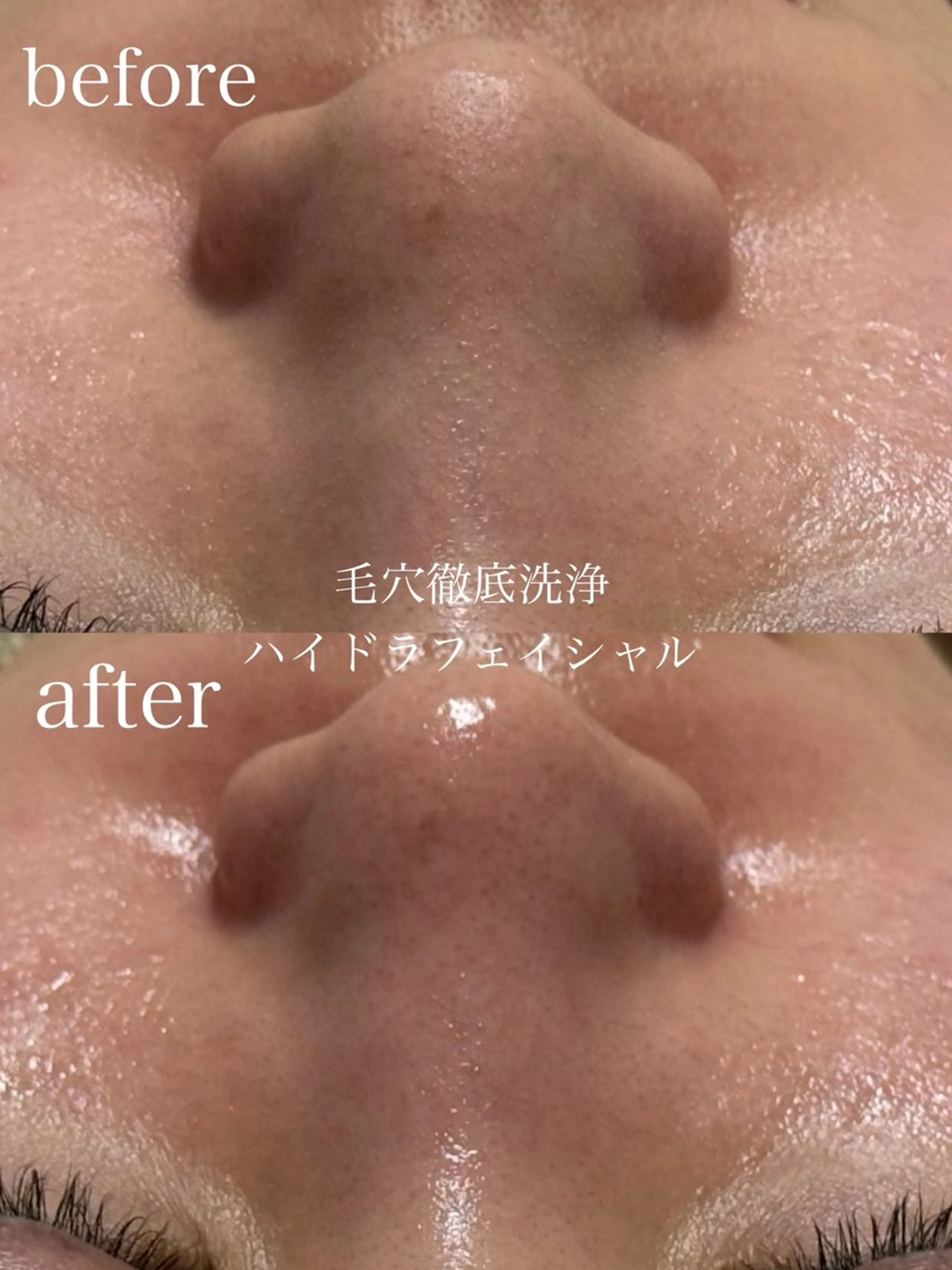 エステ フェイシャルサロン CHIARA鈴木のエステ・リラクイメージ