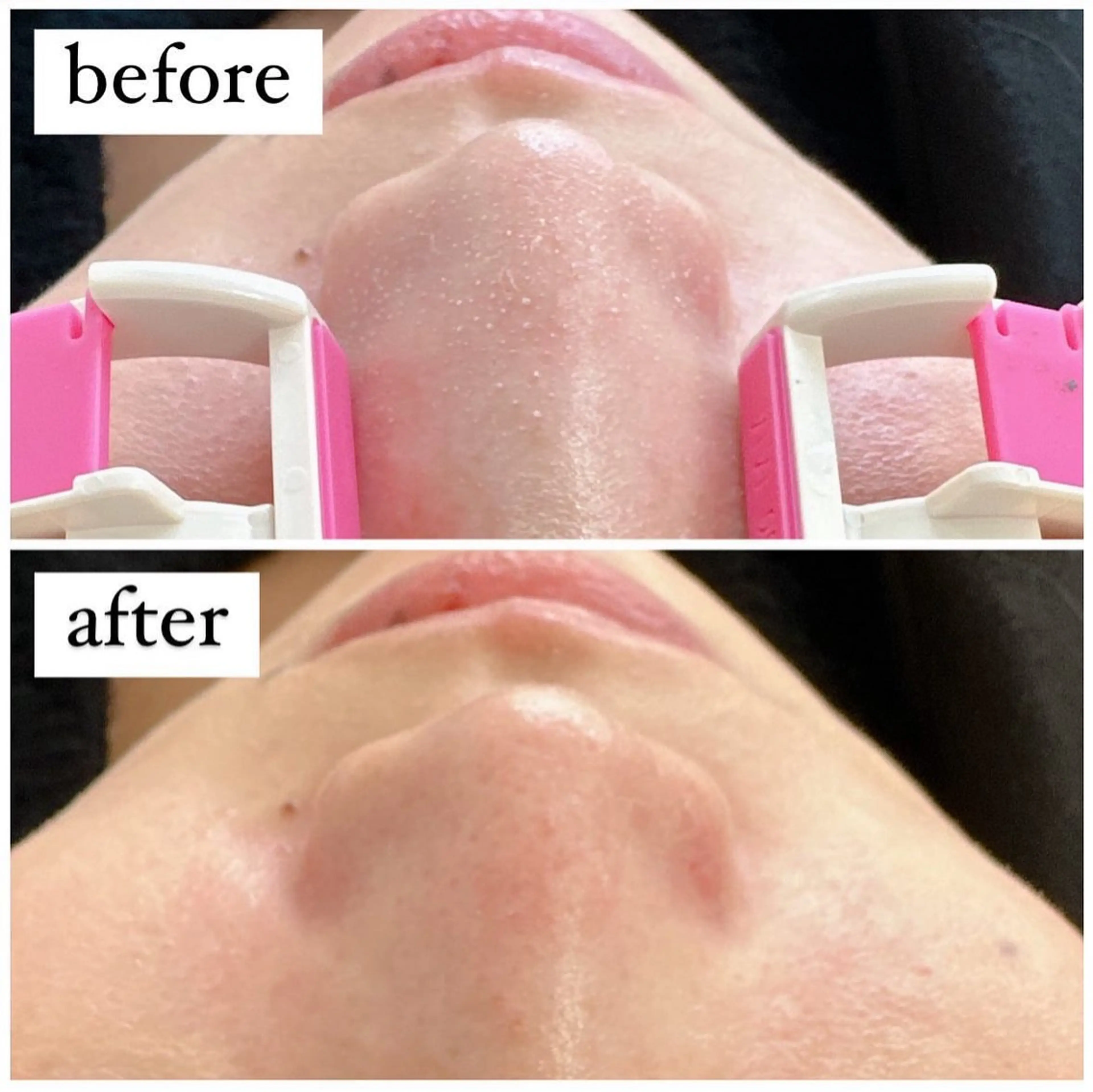 ★新登場!!プレミアム毛穴洗浄!!×30分まつ毛パーマ!の写真