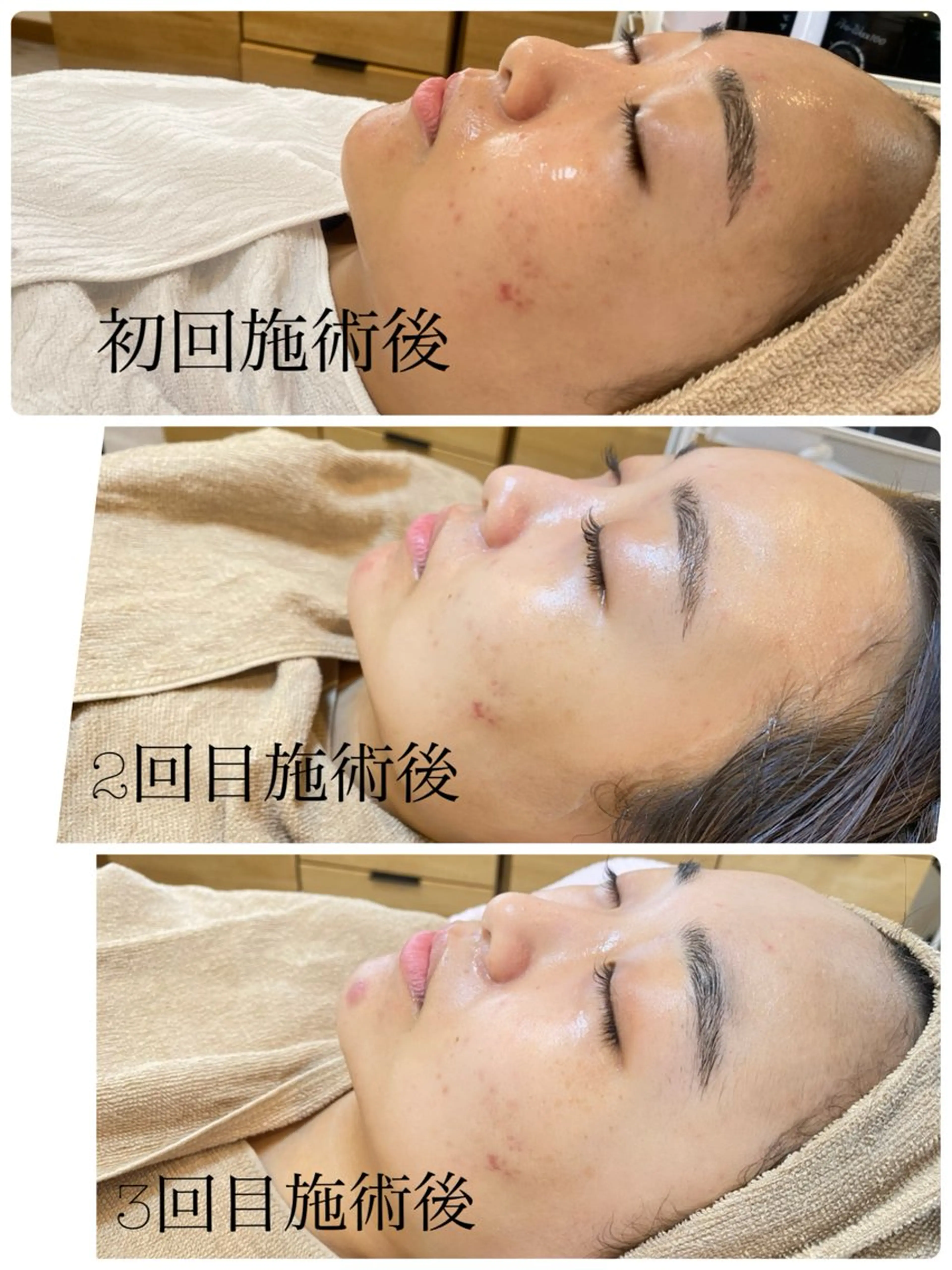 エステ まつげ屋さん こはくのマツエク・マツパデザイン