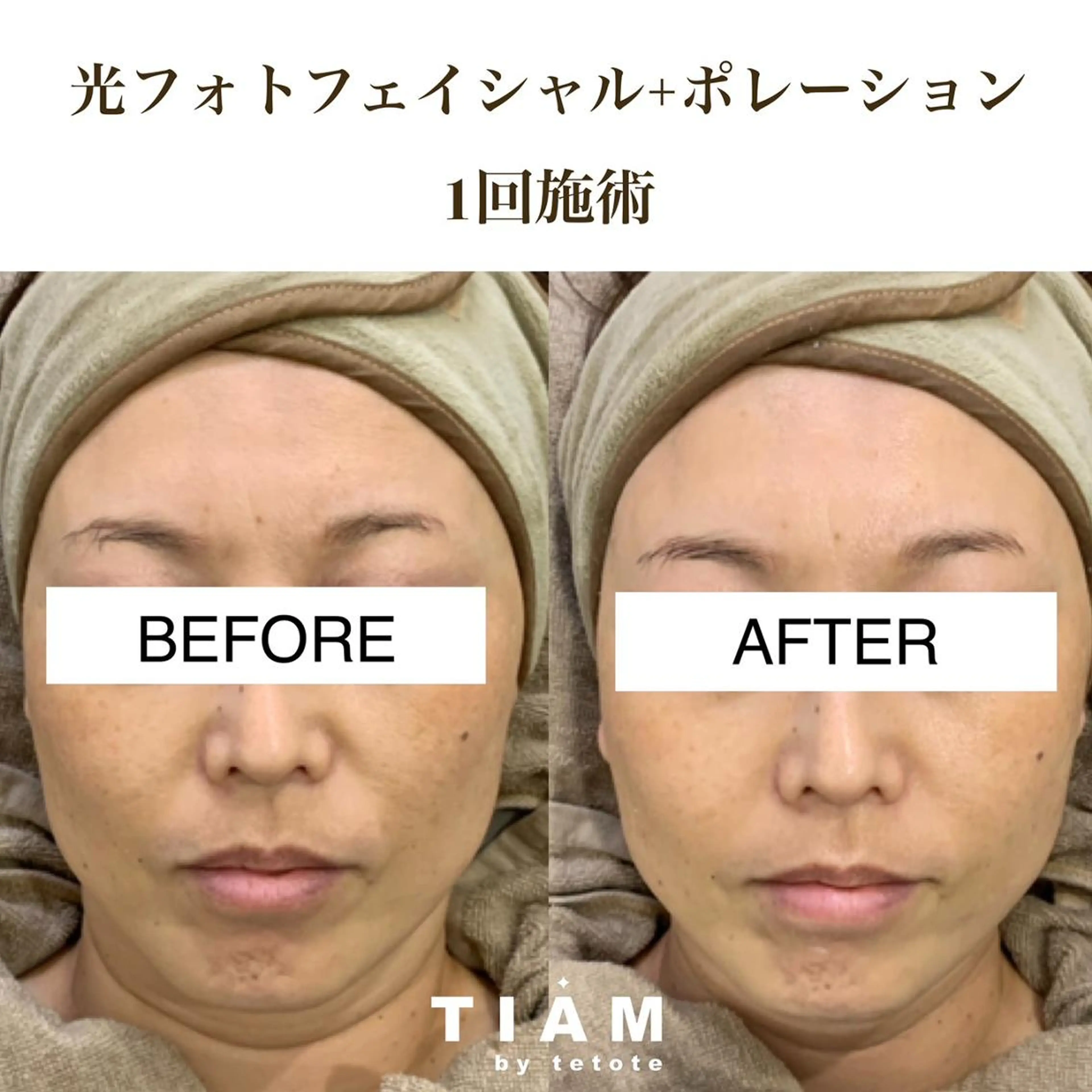 美肌サロンTIAM by tetoteのエステ・リラクイメージ