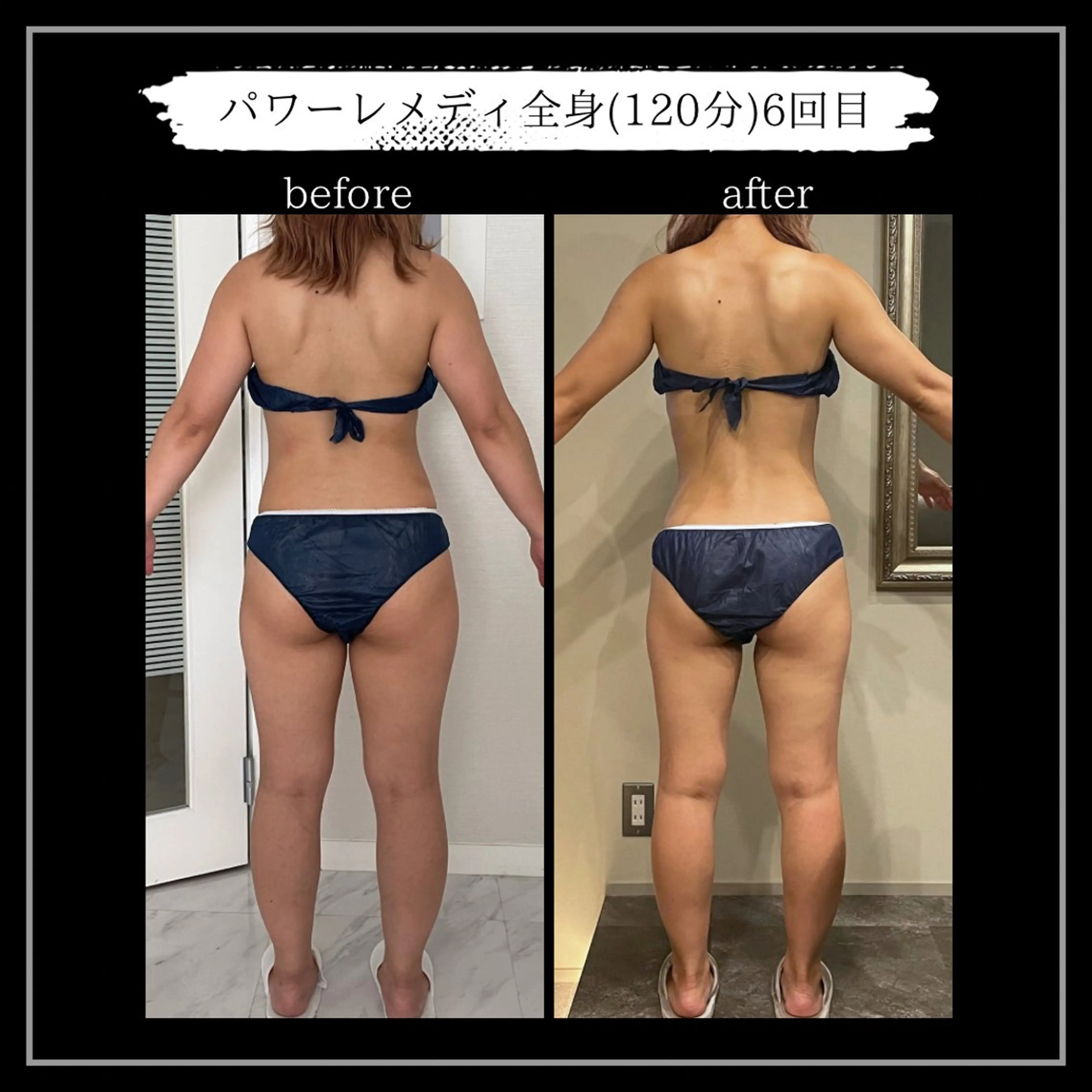 オフ:オン所属・オフ:オン 全身筋膜マッサージのエステ・リラクイメージ