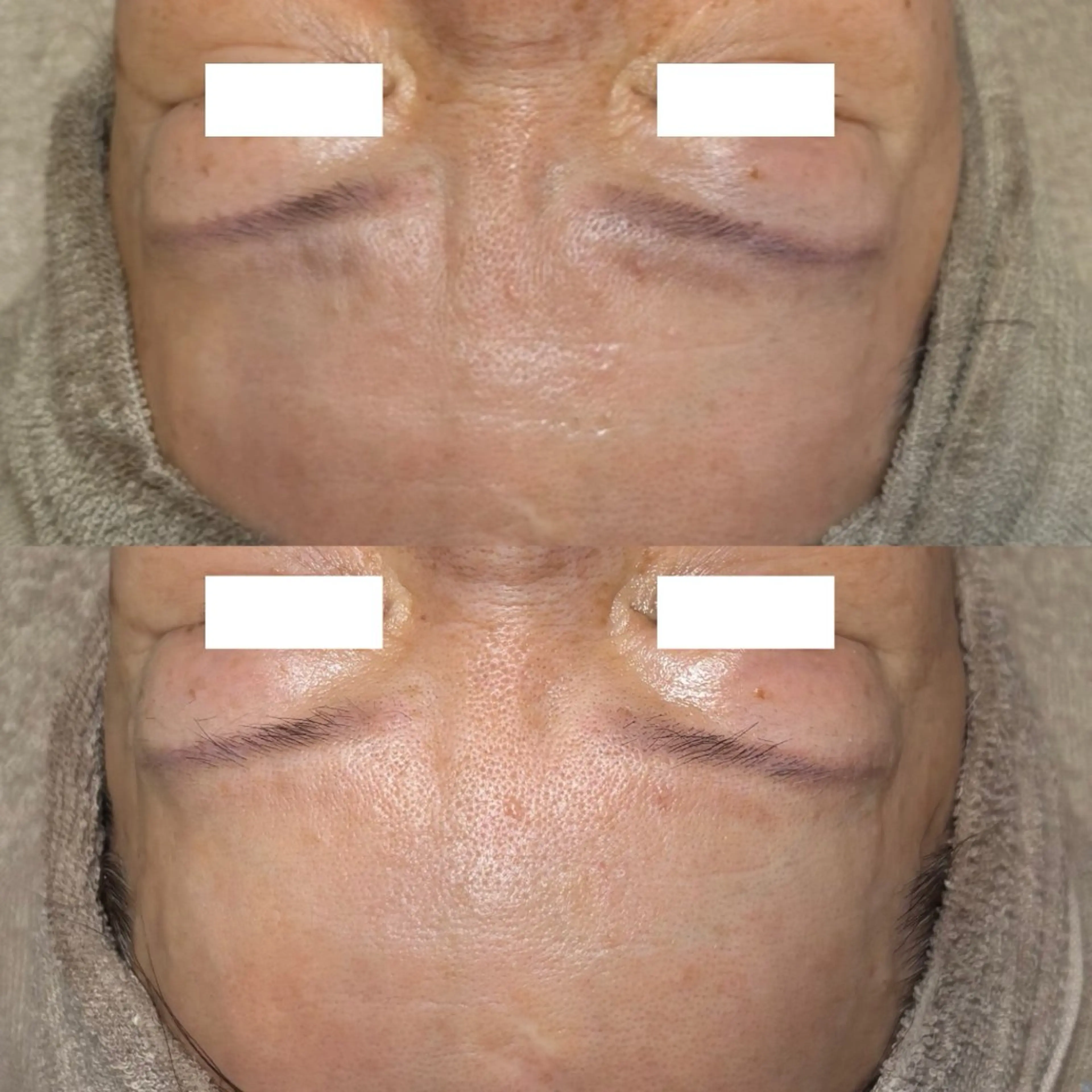 エステ Lassy Yuriの眉毛・アイブロウイメージ