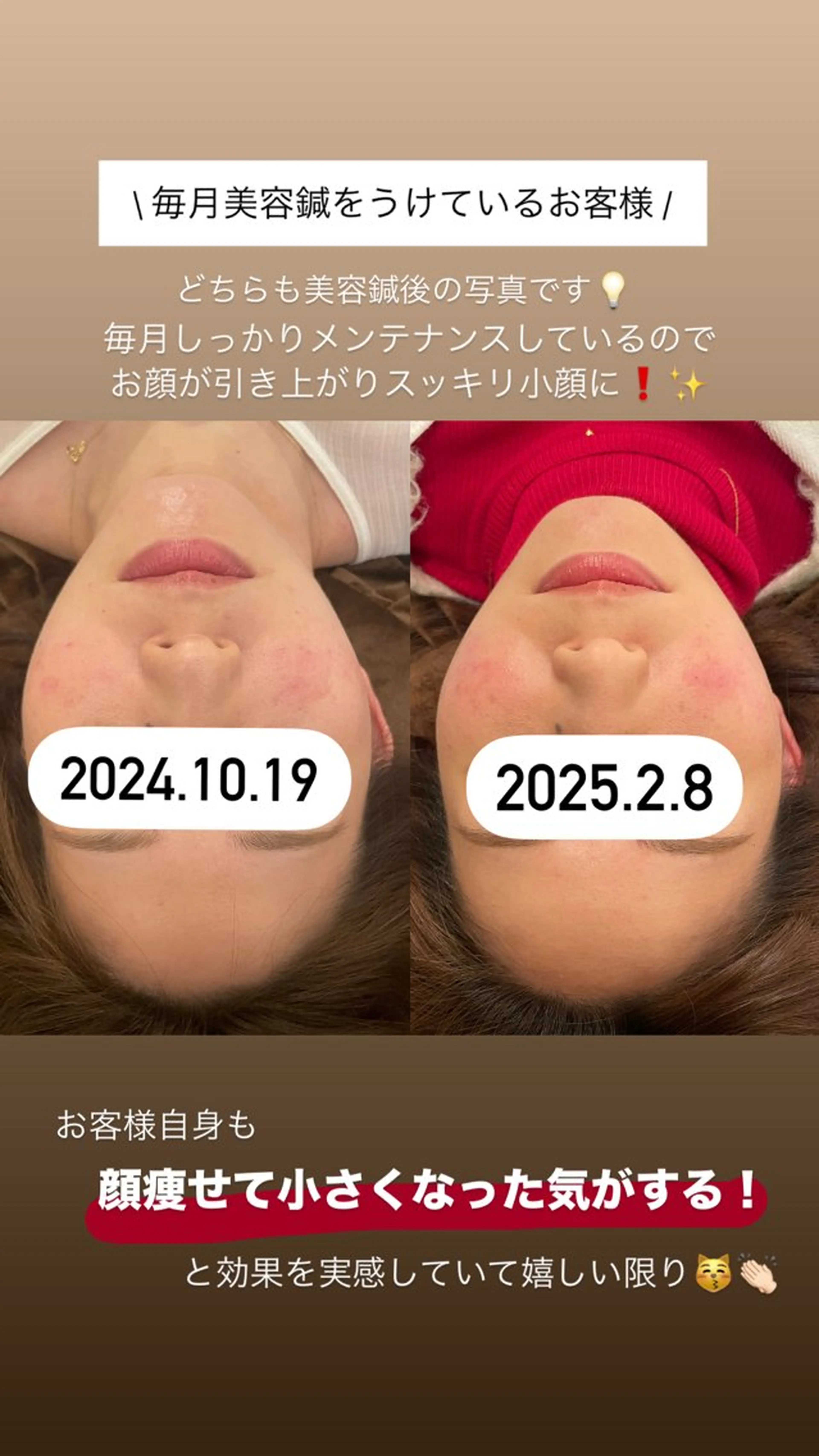 美容鍼/鍼灸 ここみ鍼灸院のエステ・リラクイメージ