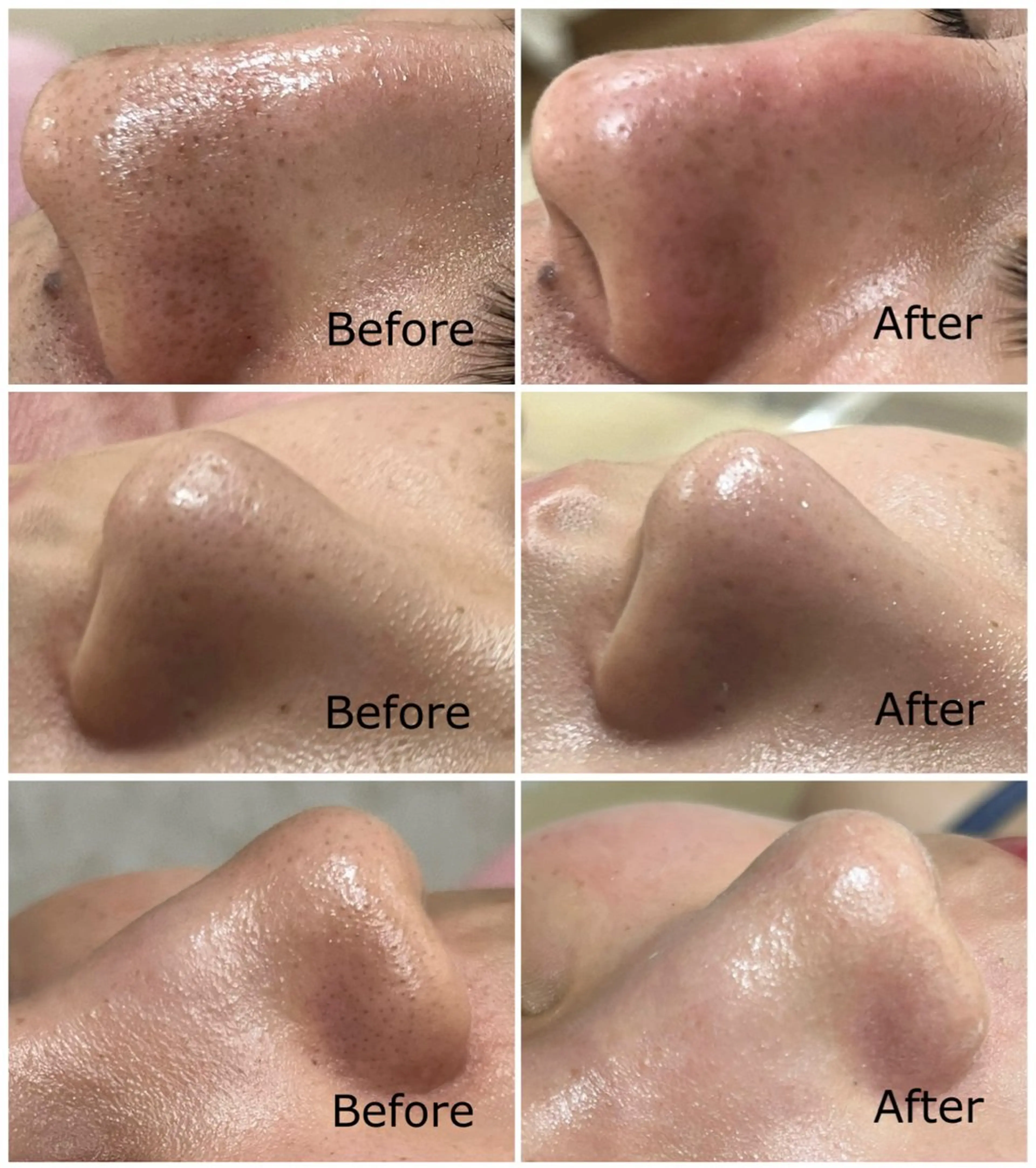 エステ フェイシャル/脱毛 ジョアアンジェ竹田のエステ・リラクイメージ