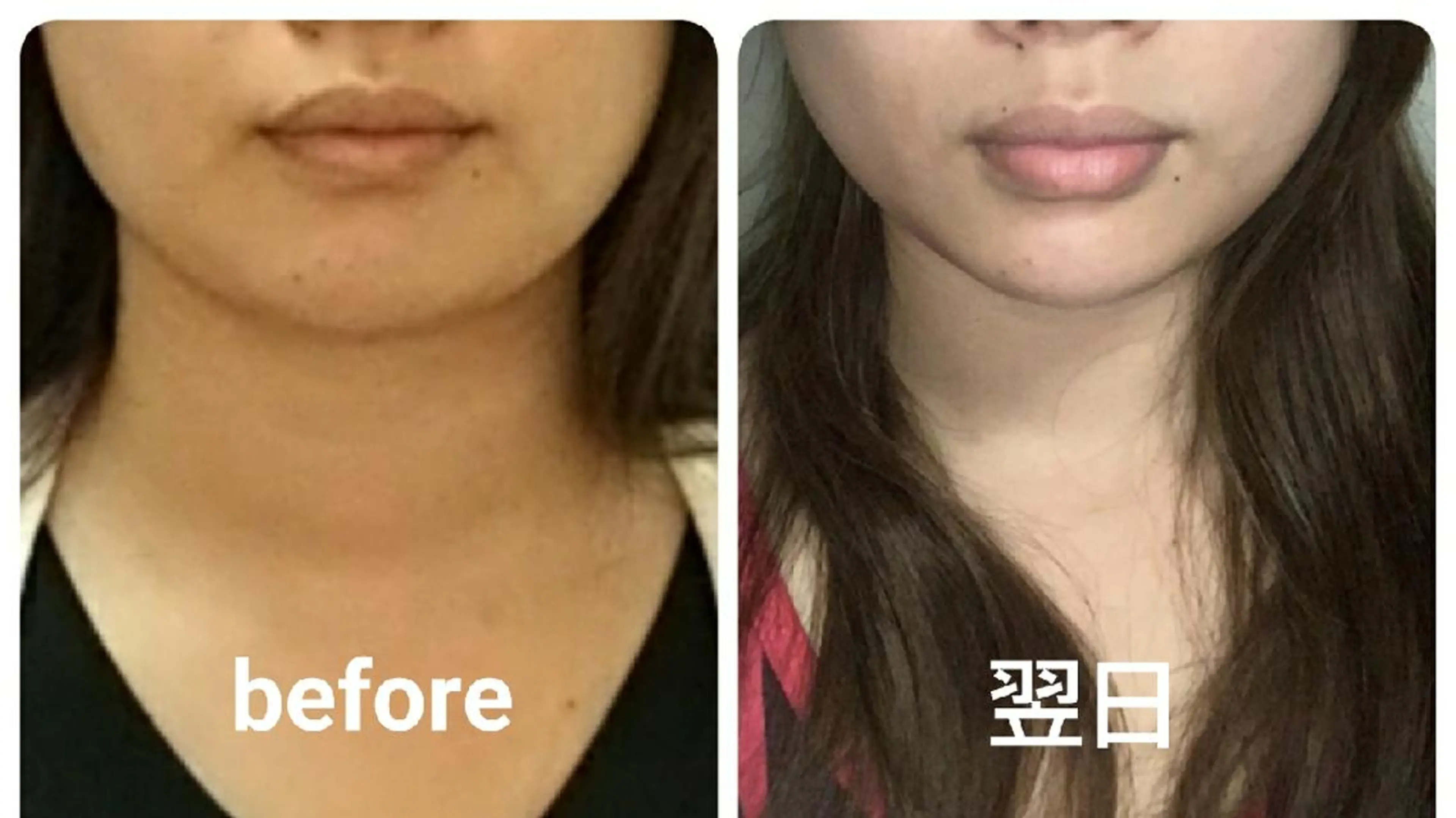 小顔と美肌 まごころエステMatoria所属・小顔 美肌専門 Matoriaのエステ・リラクイメージ