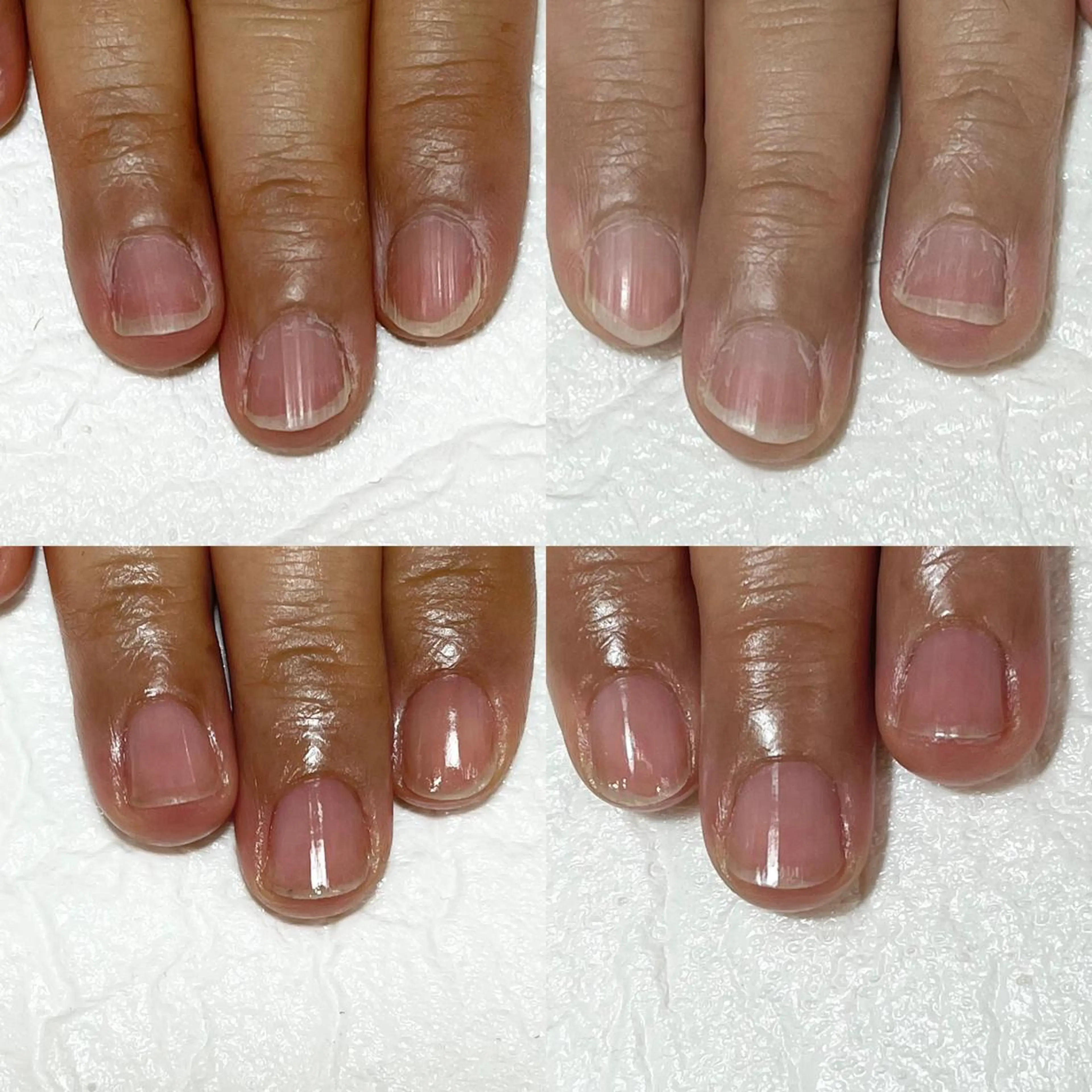 【初回カウンセリング無料】地爪育成ハンドケアの写真