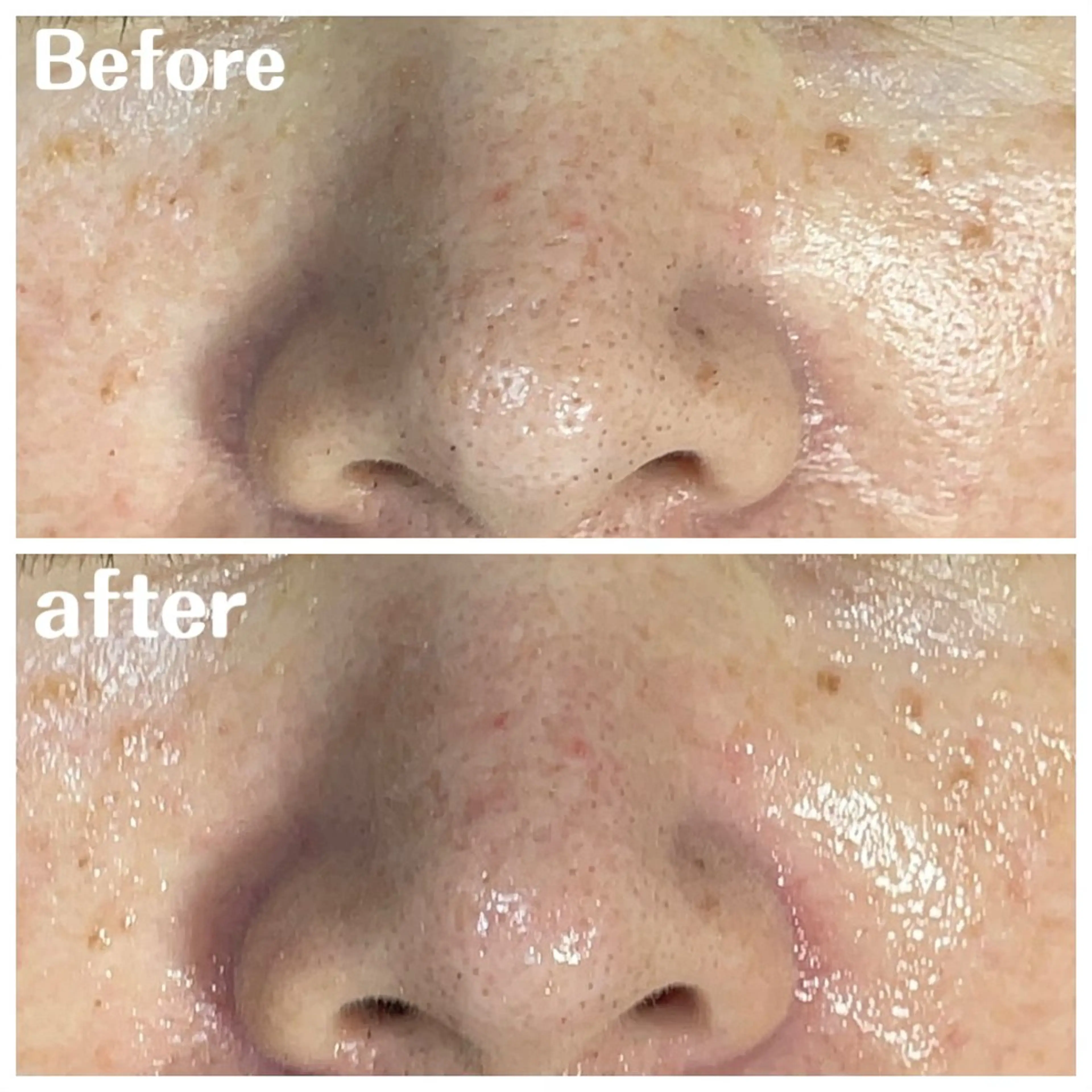 肌質改善サロン facialmoonのエステ・リラクイメージ