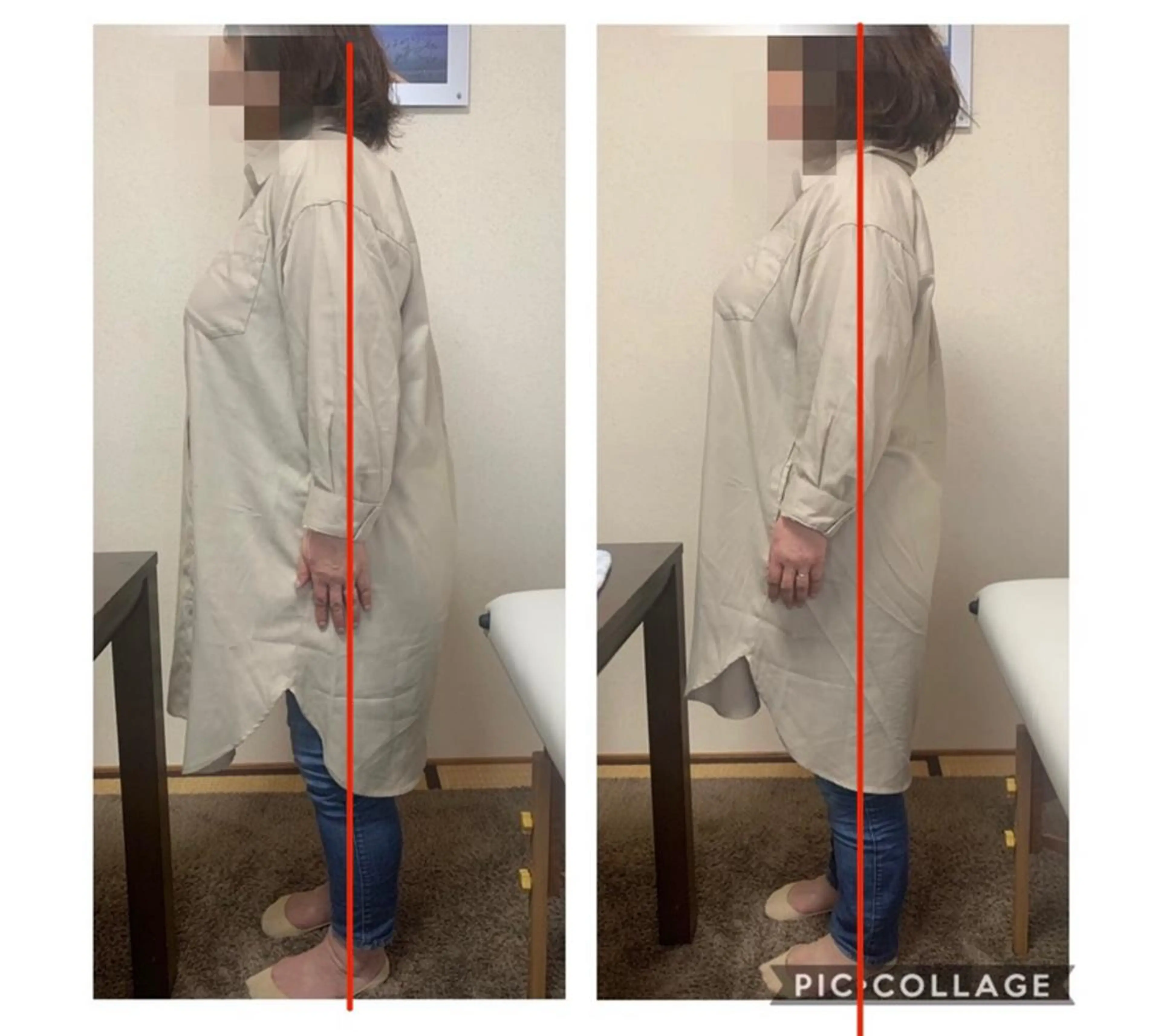 足の付け根が痛くて歩くのがつらい！お試しキャンペーン(2回で1,980円)の写真