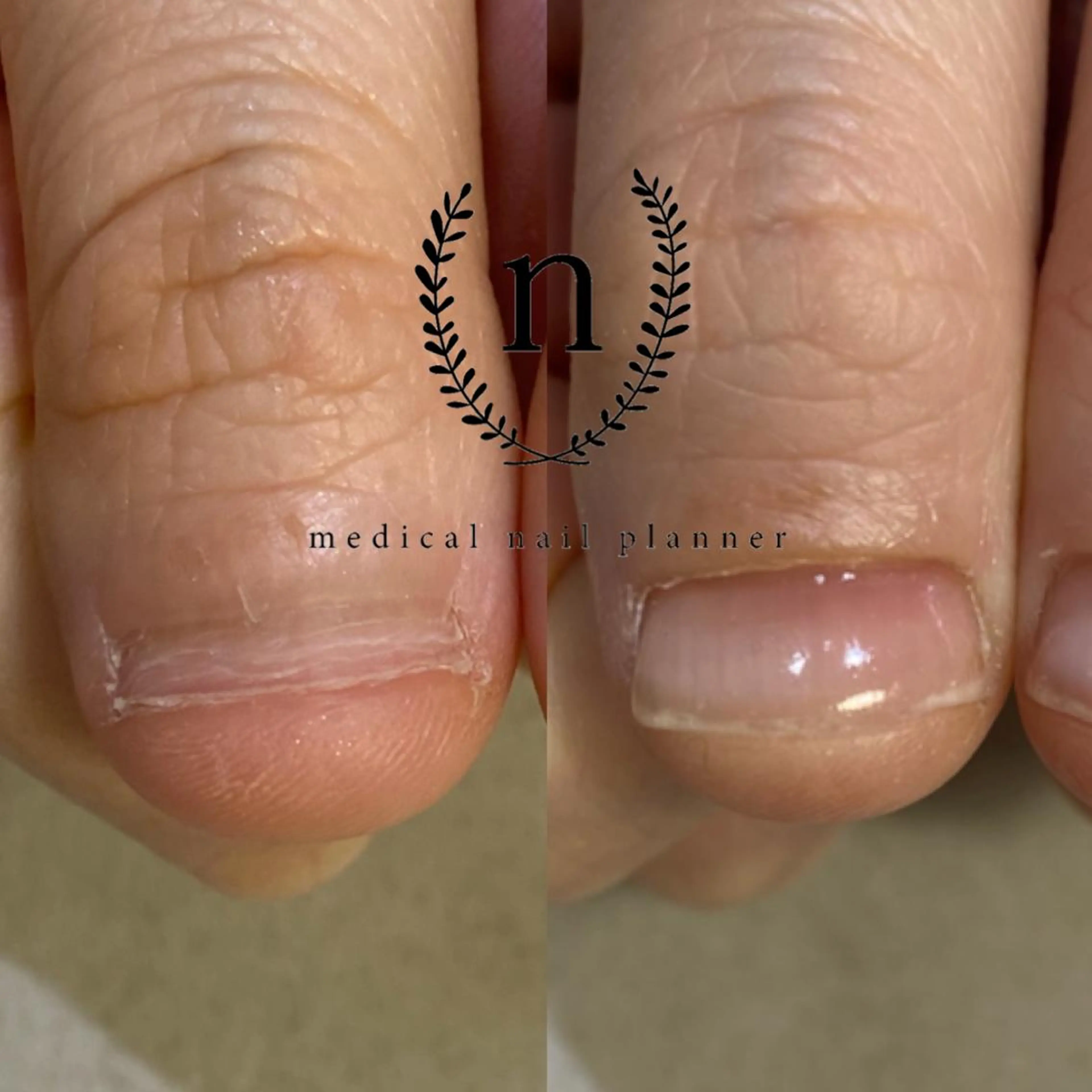 ネイル Rio 𓍼のネイルデザイン