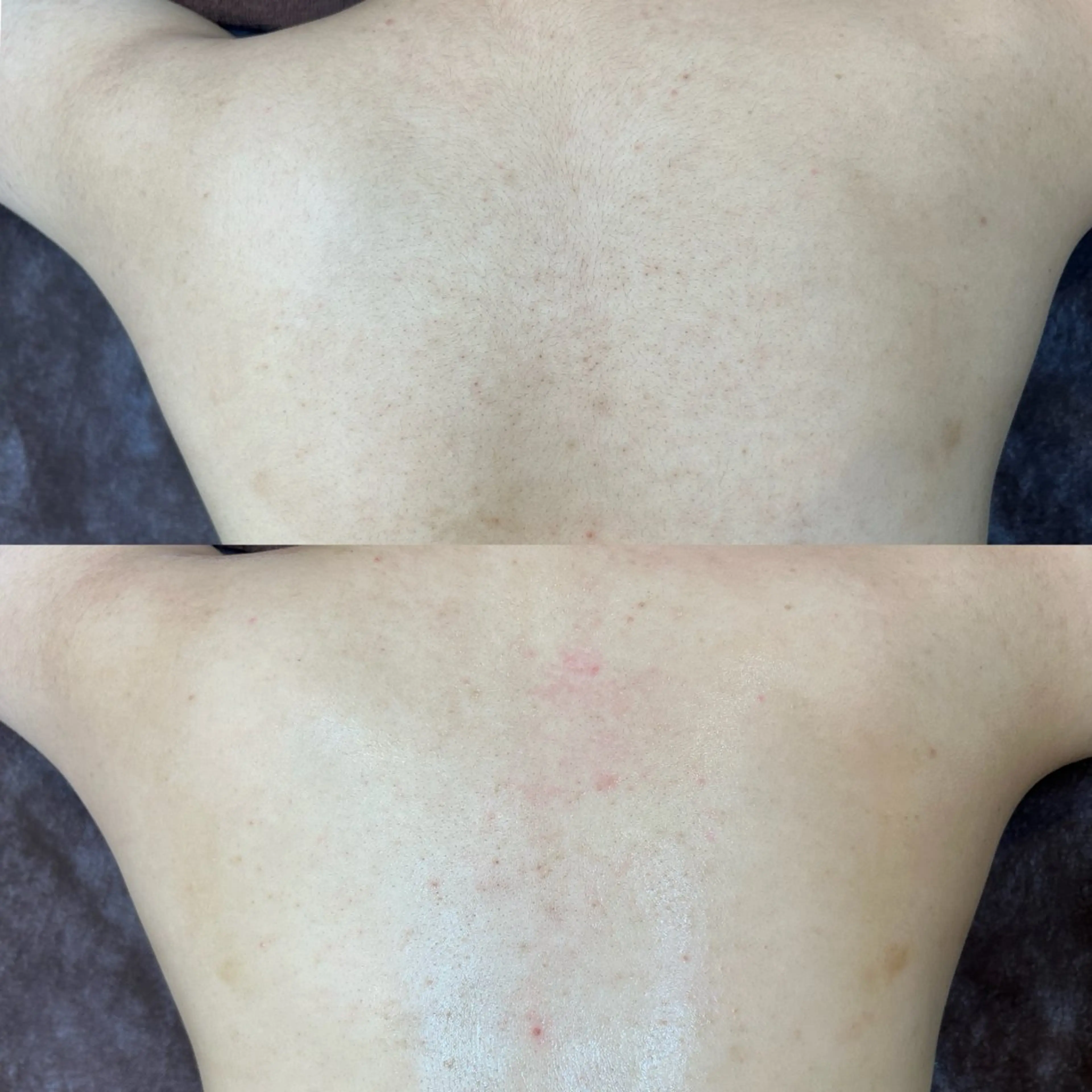 脱毛 プライベートサロン リプレイスのエステ・リラクイメージ