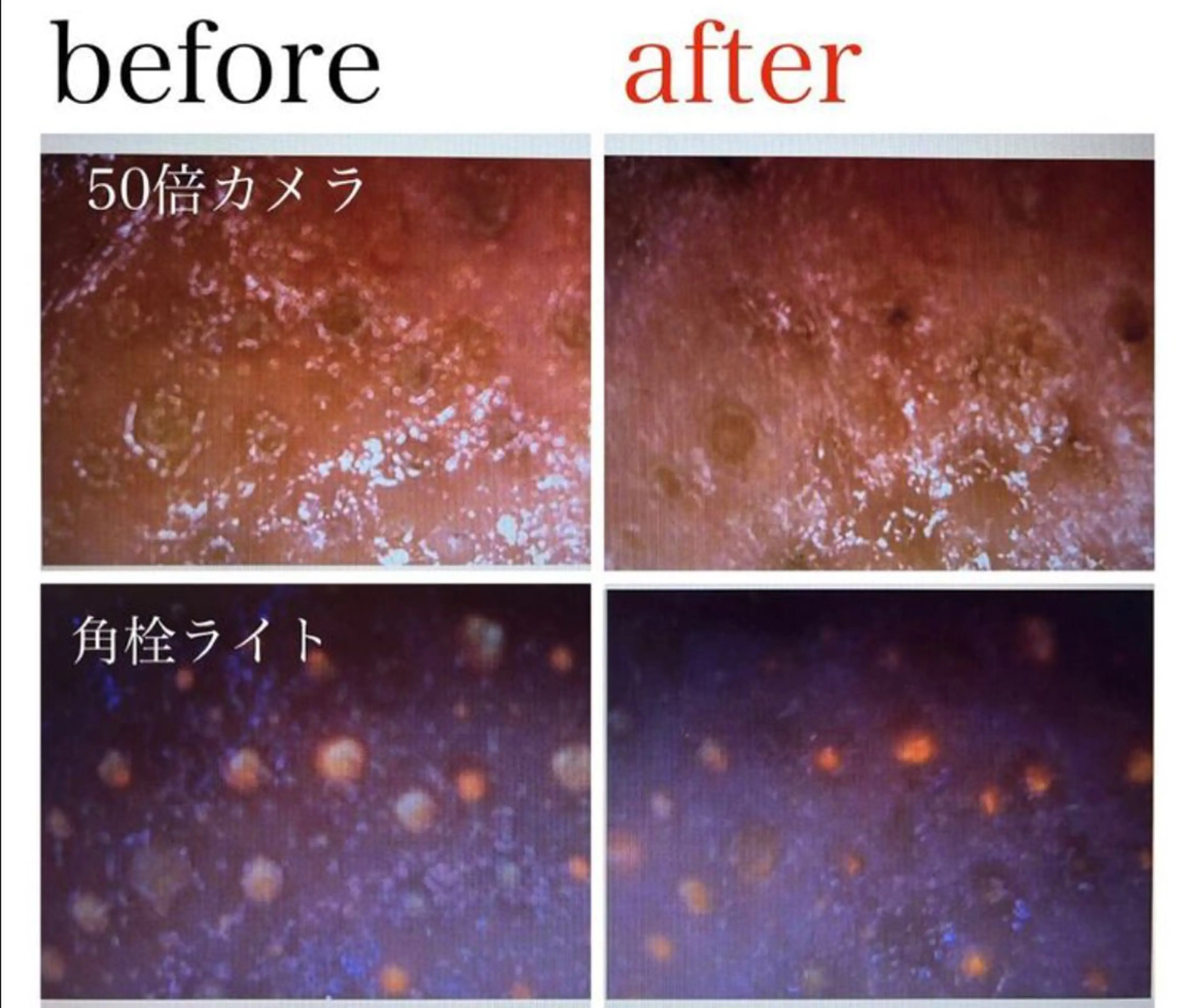 ポアレスサロン フィルのエステ・リラクイメージ