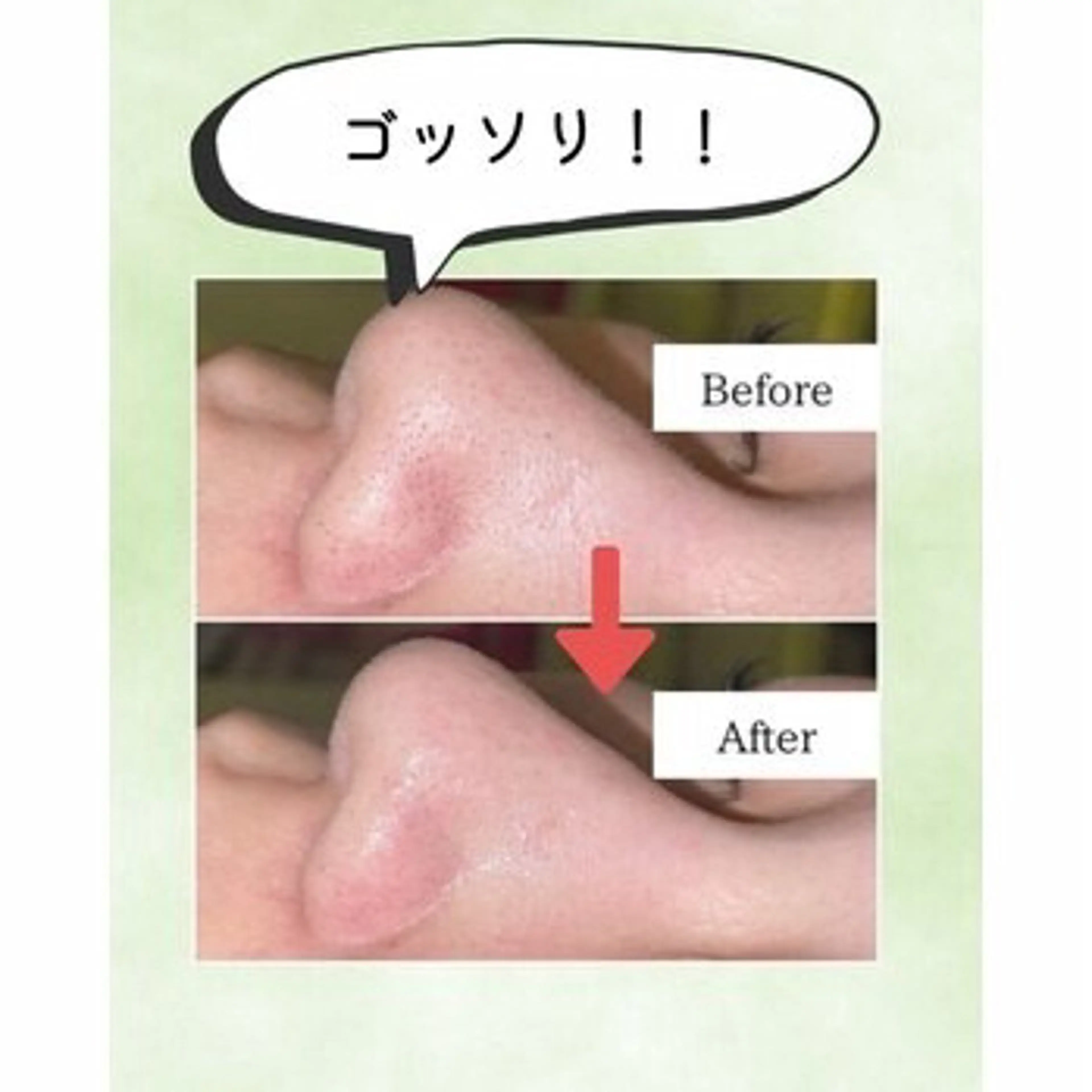 毛穴レス肌へ!ハイドラフェイシャルの写真