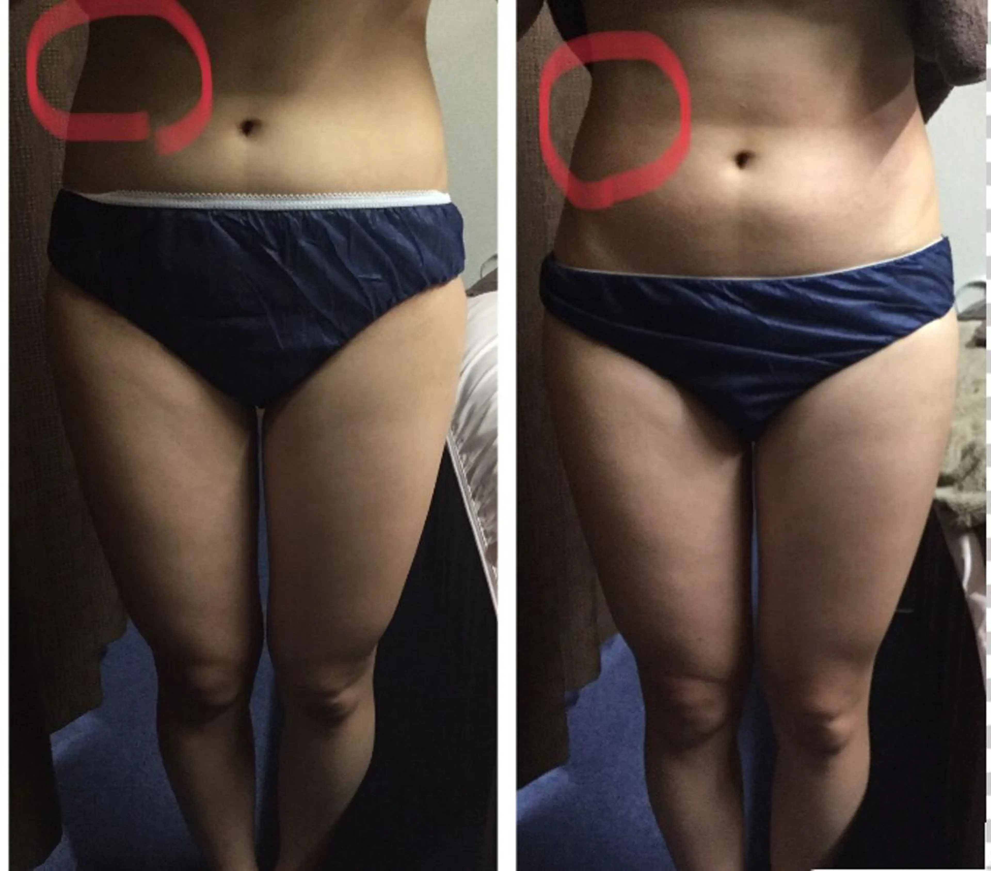 鍼灸サロン RUCEのエステ・リラクイメージ