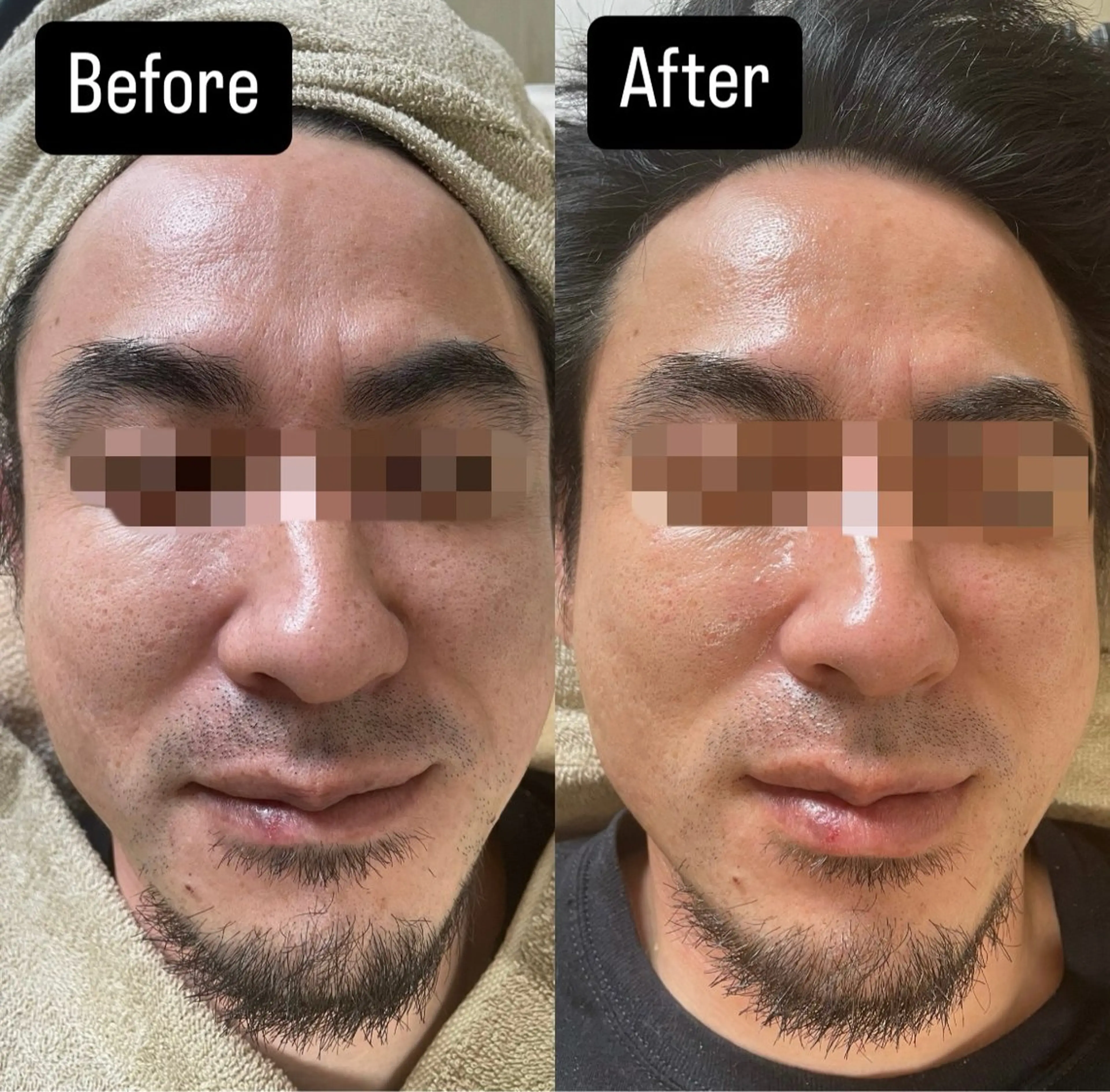 エステ プライベートサロン Belle（ベル）のエステ・リラクイメージ