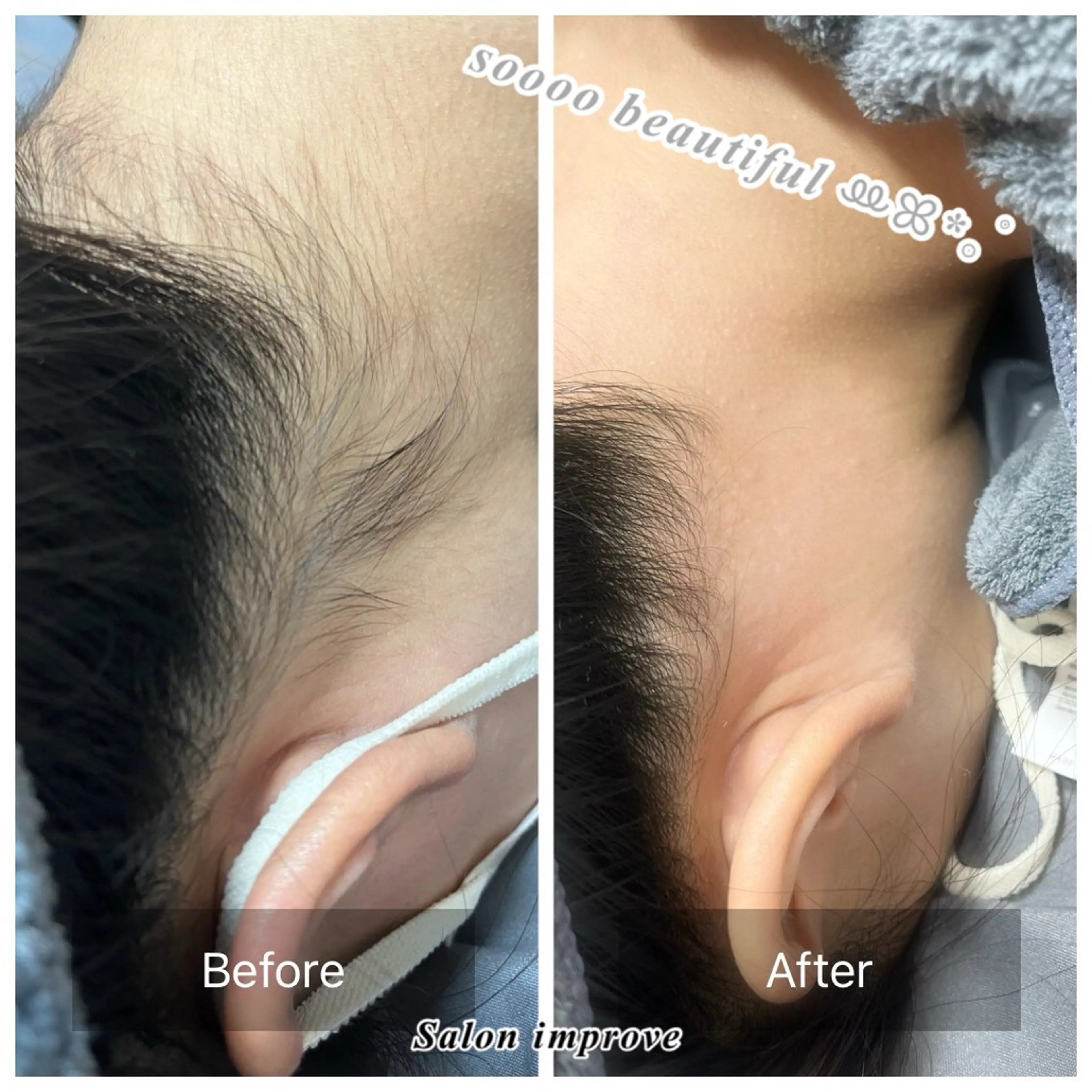 脱毛 salon improve所属・Salon Improveのネイルデザイン