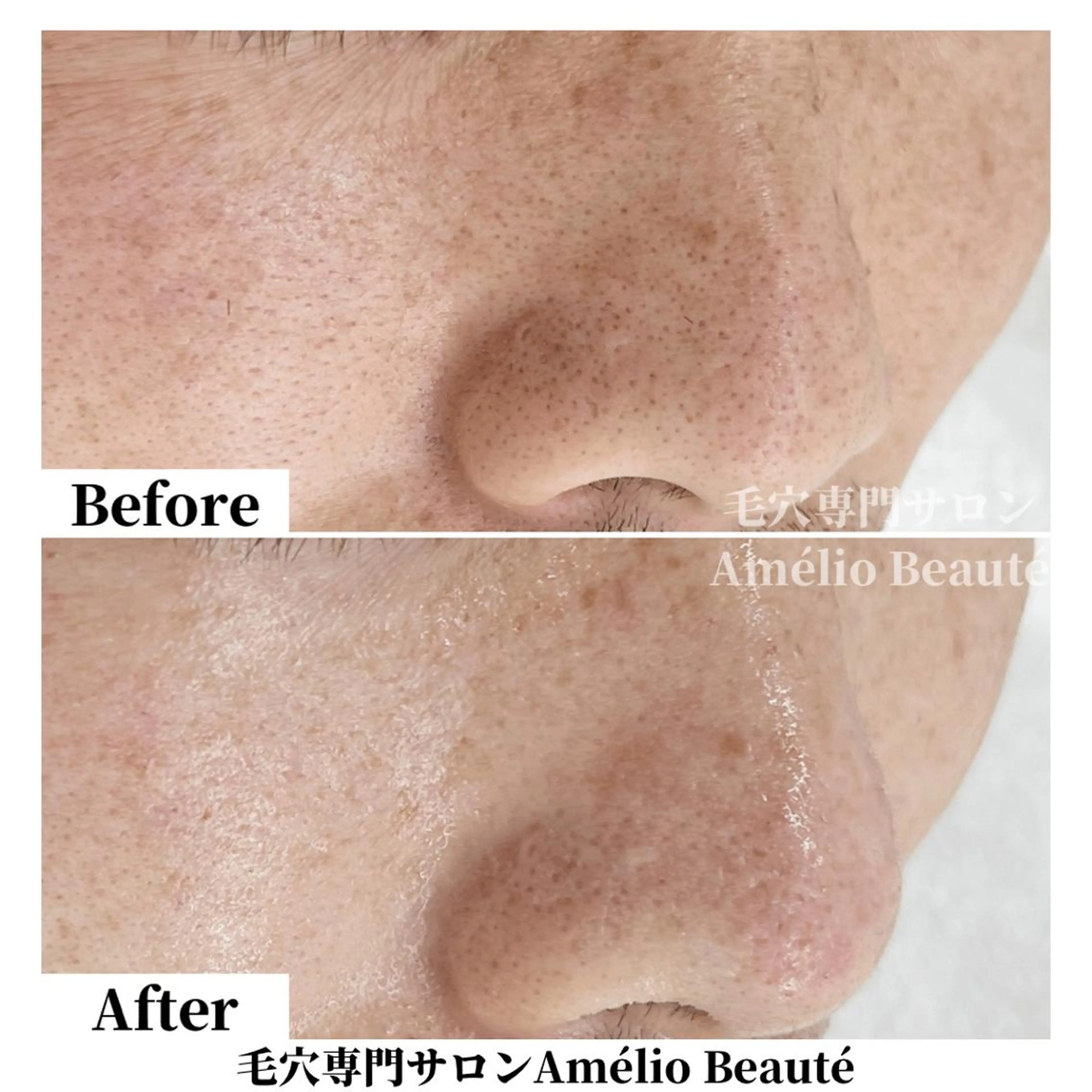 毛穴ケア専門サロン Amélio Beauté所属・毛穴ケア専門サロン アメリオボーテのその他イメージ
