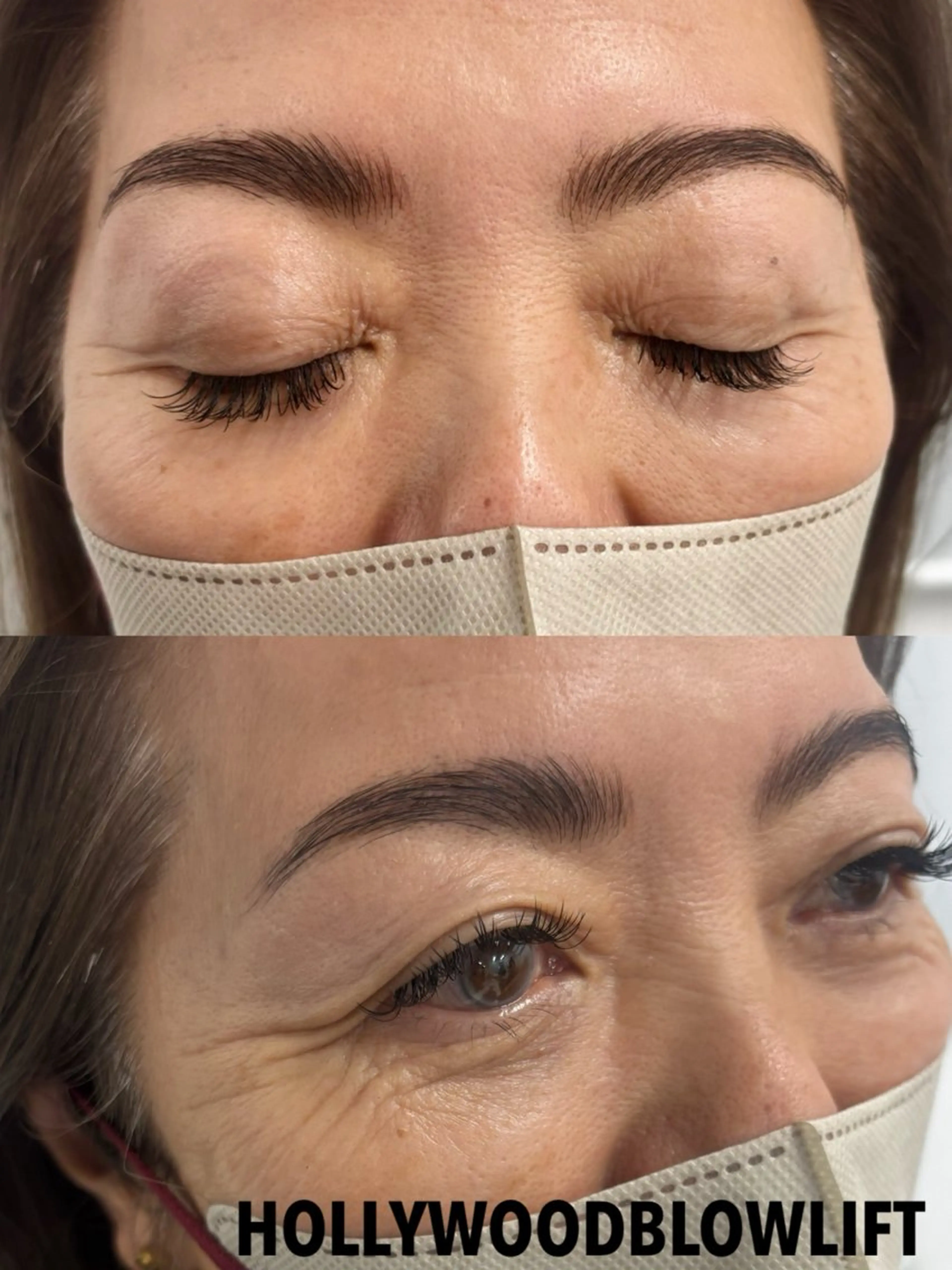 圧倒的人気✧︎*。外人風ハリウッドブロウリフト眉癖改善(おでこパーツまたはBTX付き)の写真