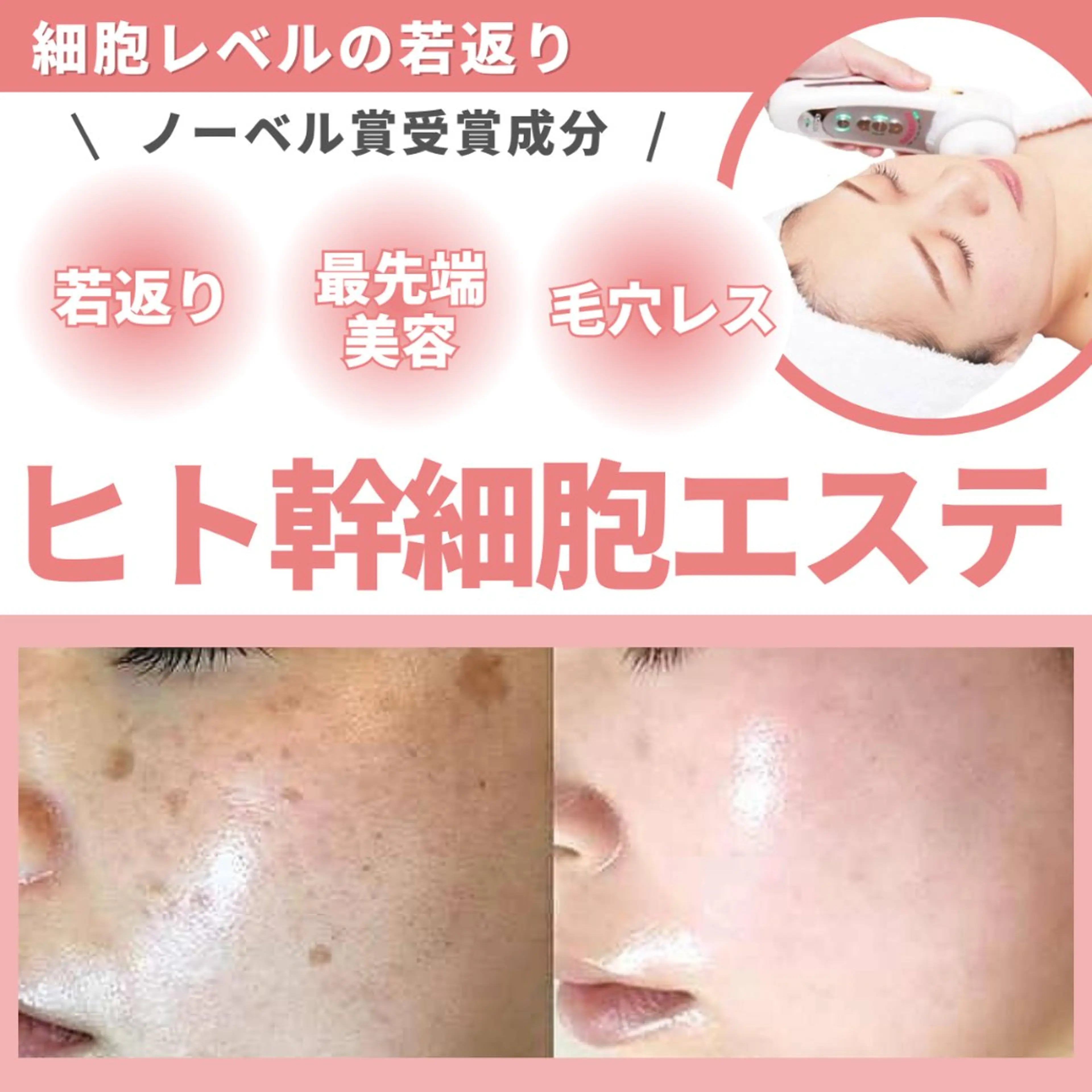 エステ エステサロン JURISのエステ・リラクイメージ