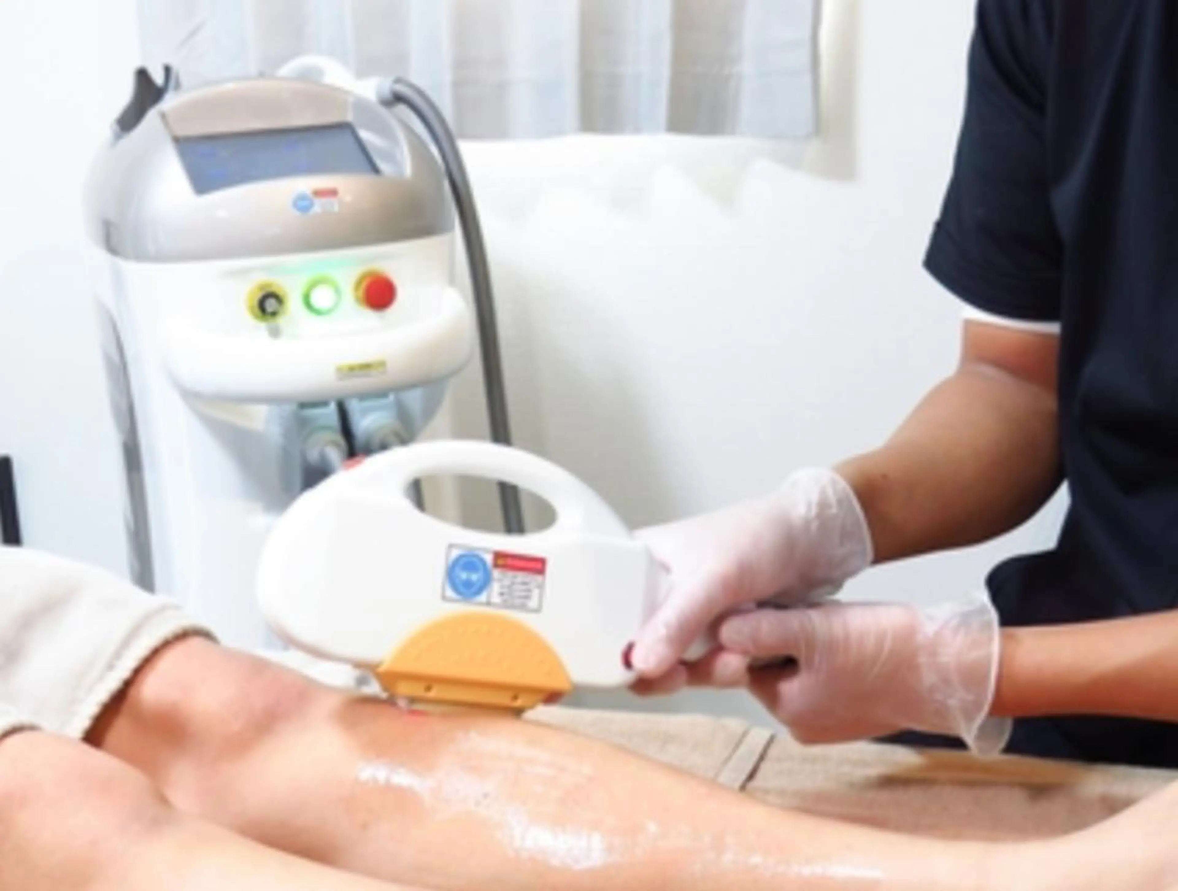 【初回限定】スピード脱毛 全身1回¥19,800→¥5,500（脱毛部位はご希望に応じます）の写真