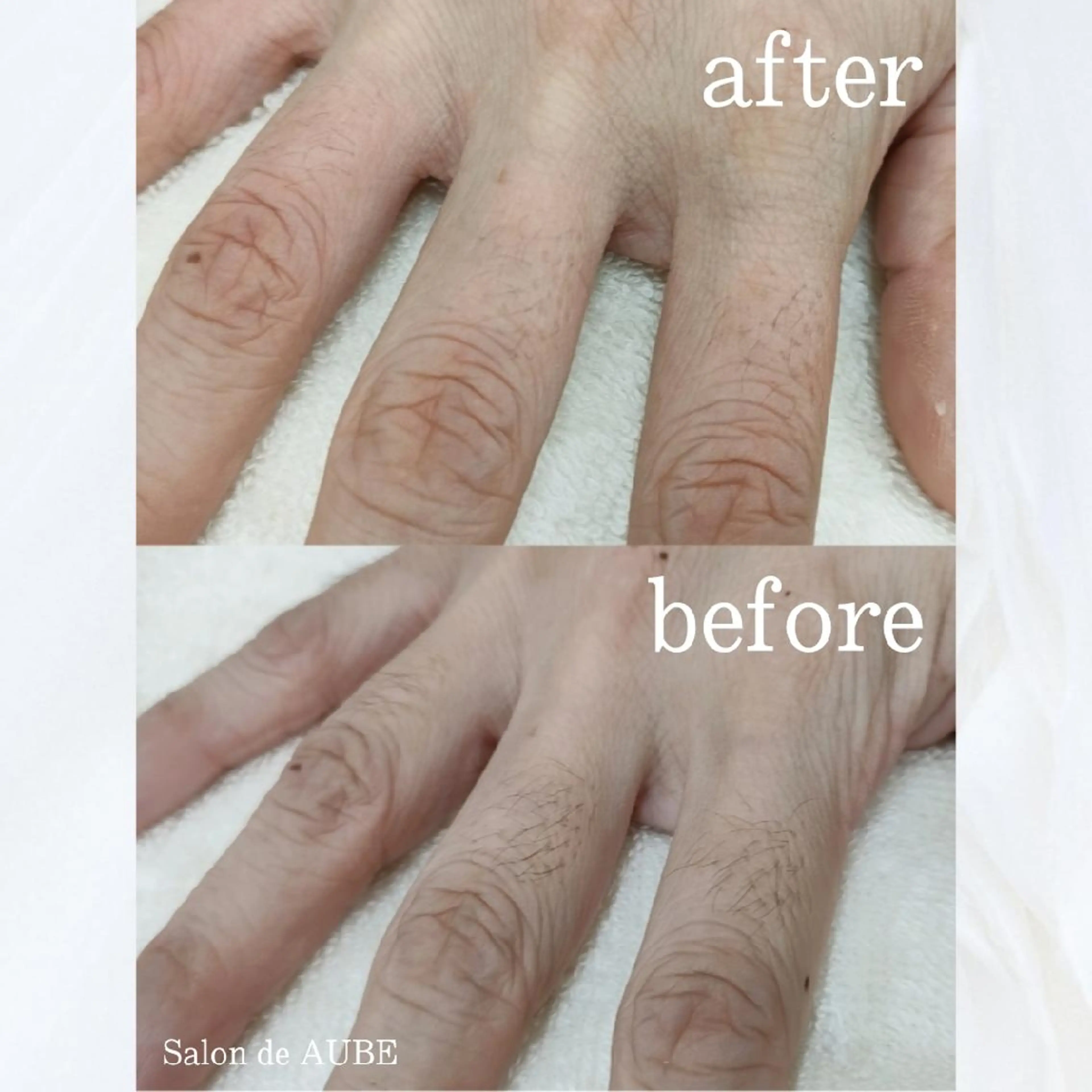 電気脱毛 Salon de AUBEのエステ・リラクイメージ