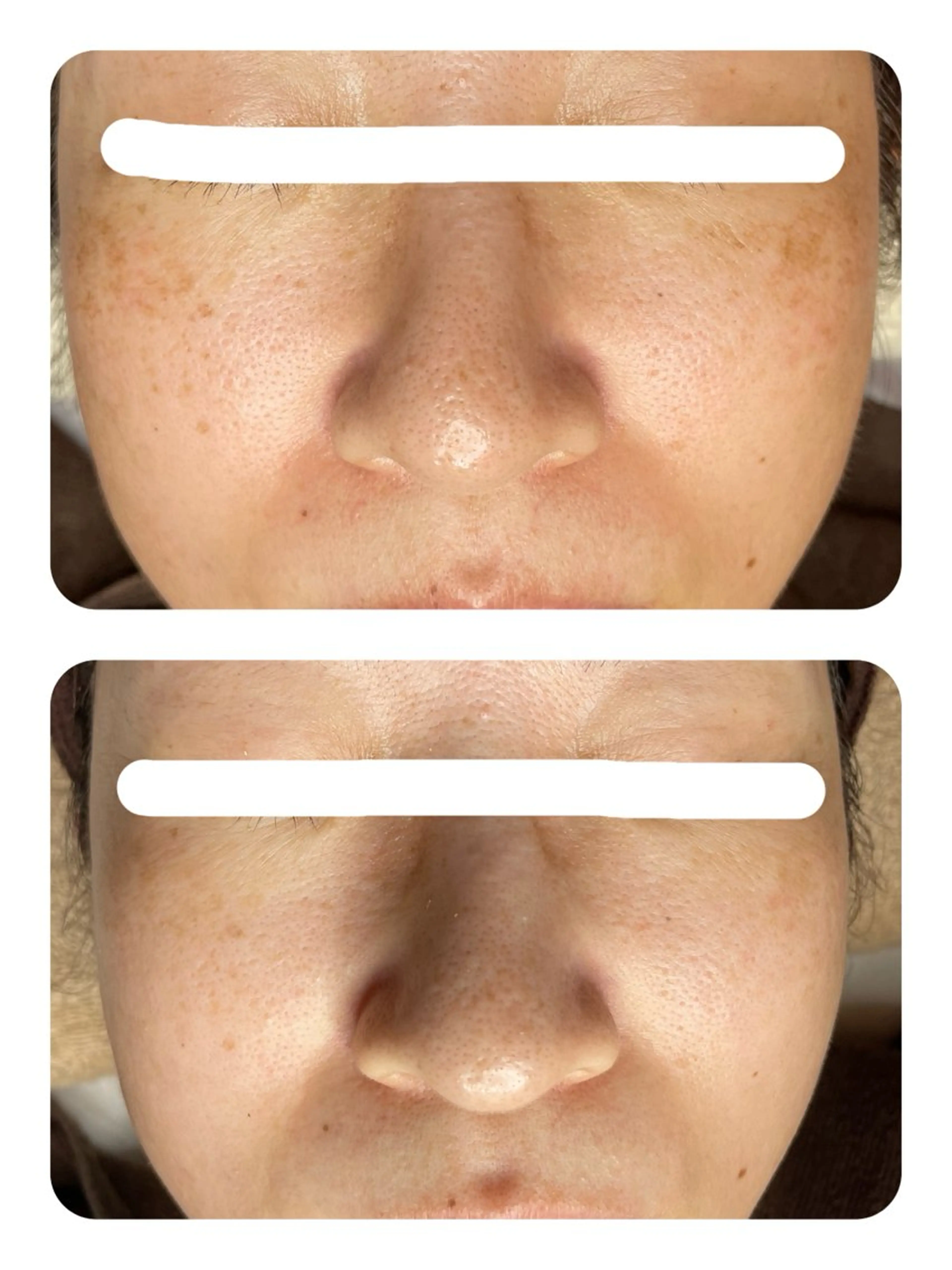 エステ TIERRA(ティエラ)所属・TIERRA ♡のエステ・リラクイメージ