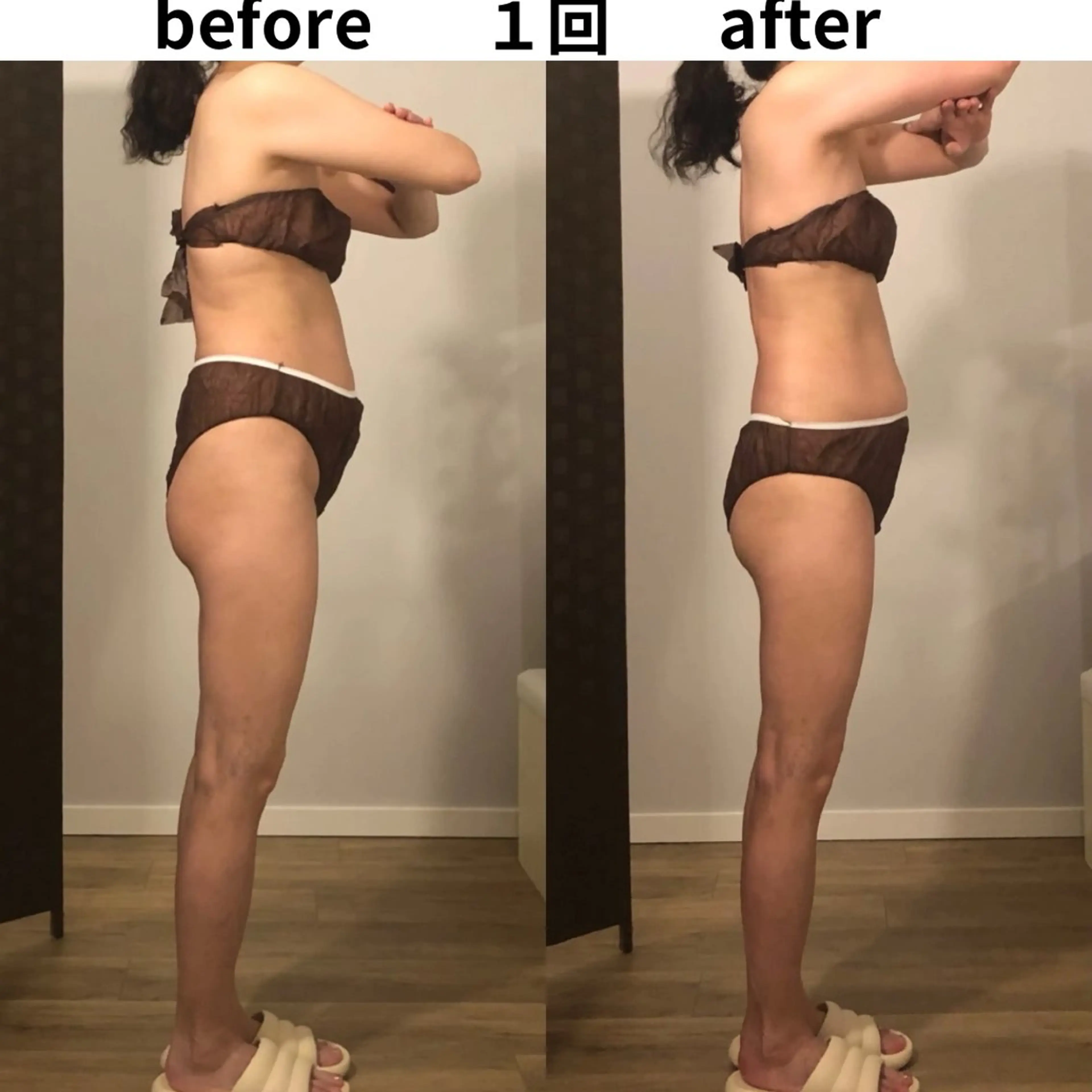 小顔・痩身専門店 Sunao所属・小顔.足痩せ整体 痩身天六Sunaoのその他イメージ