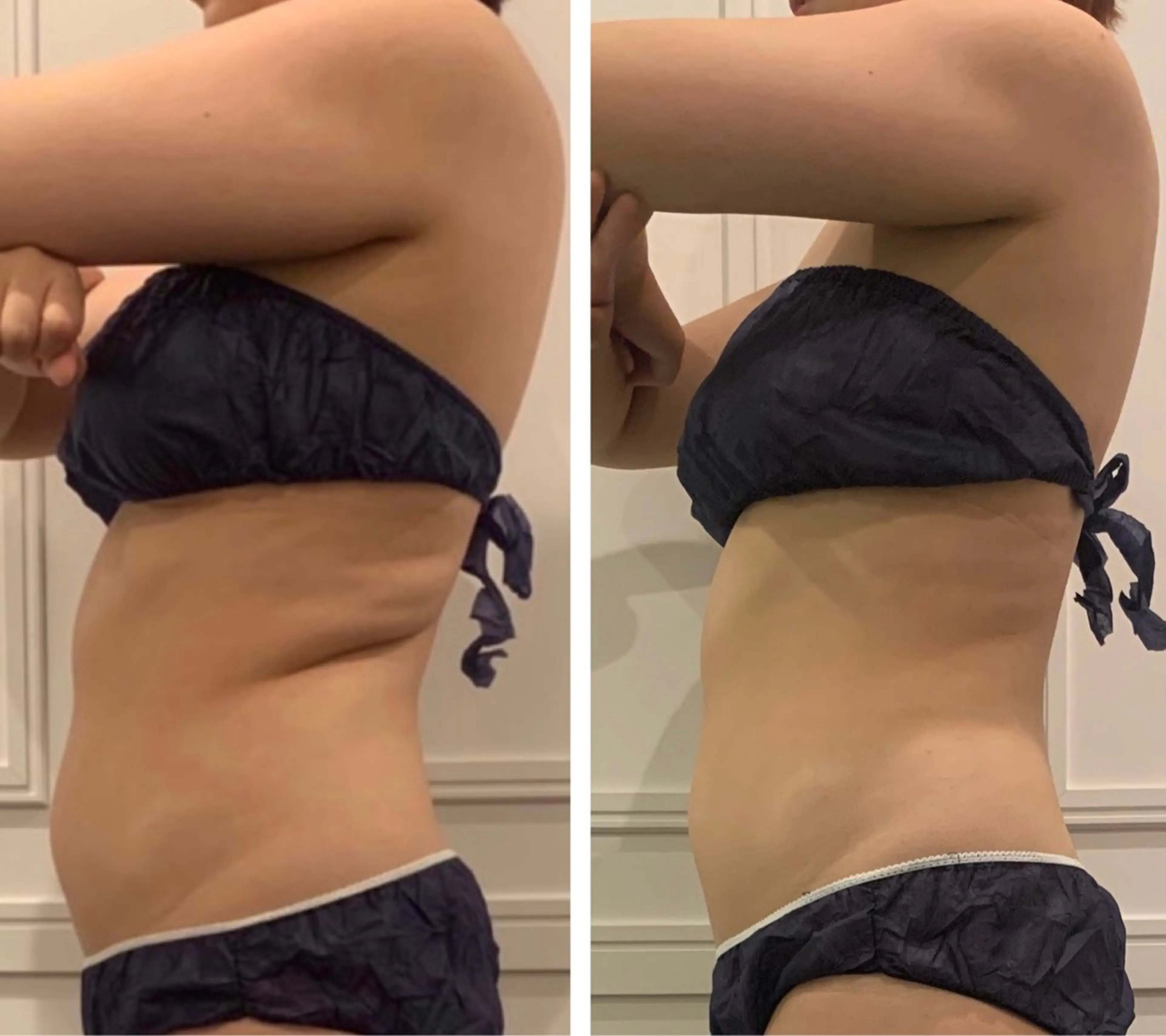 【内臓脂肪にアタック！お腹集中ケア】ハイパーナイフEXで内臓までしっかりアプローチ🔥の写真