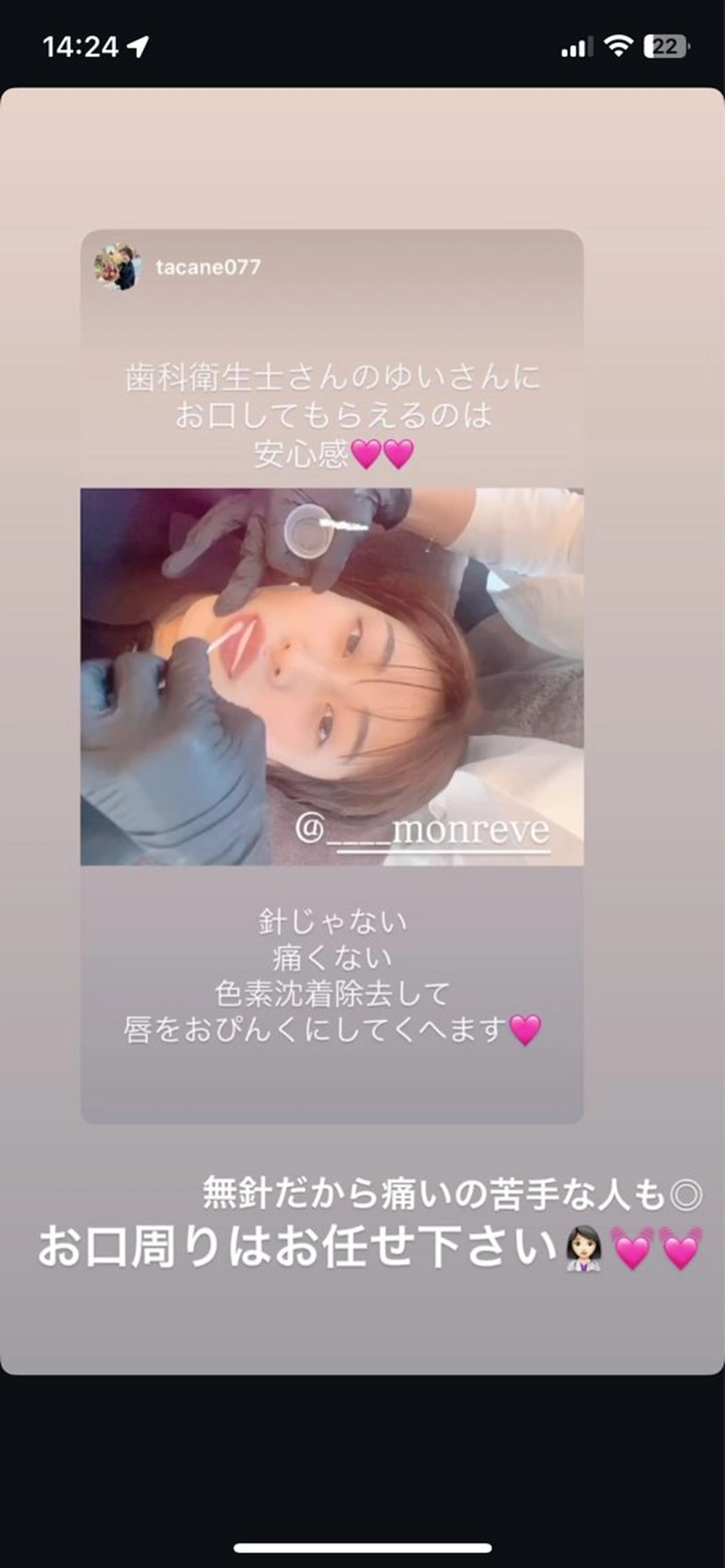 Monreve所属・美人スイッチdiet スーパージェクションのその他イメージ