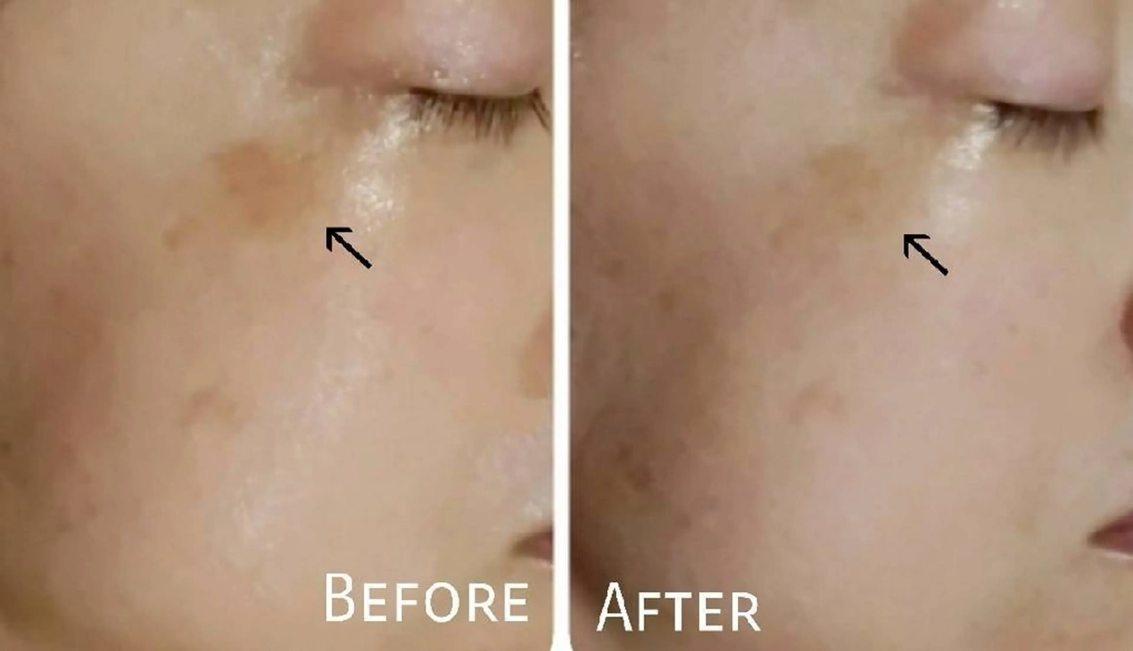 エステ ICHOOSE/ 代々木上原のエステ・リラクイメージ