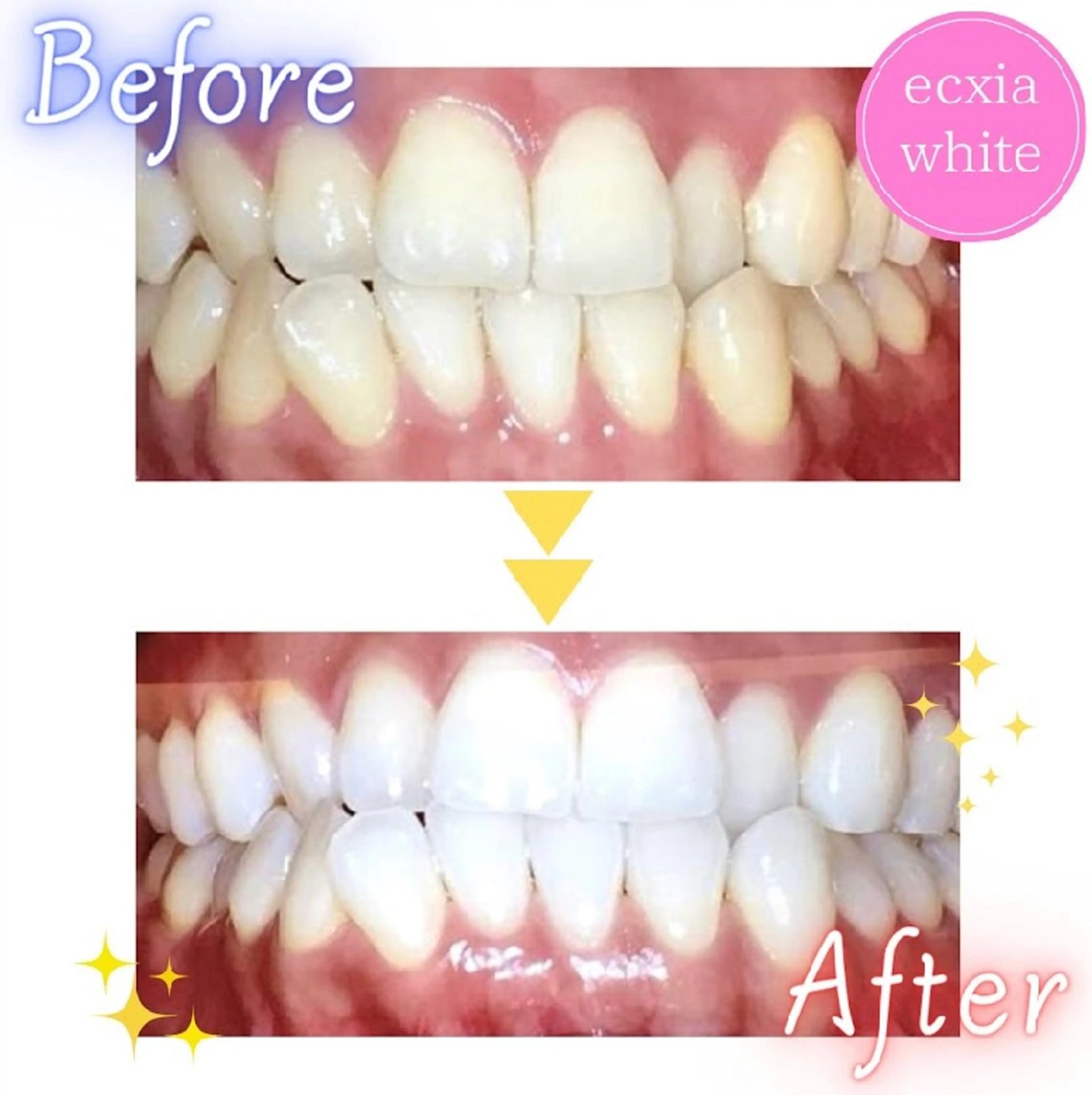 その他 エクシアホワイトニング草津店所属・nanami -ホワイトニングのその他イメージ