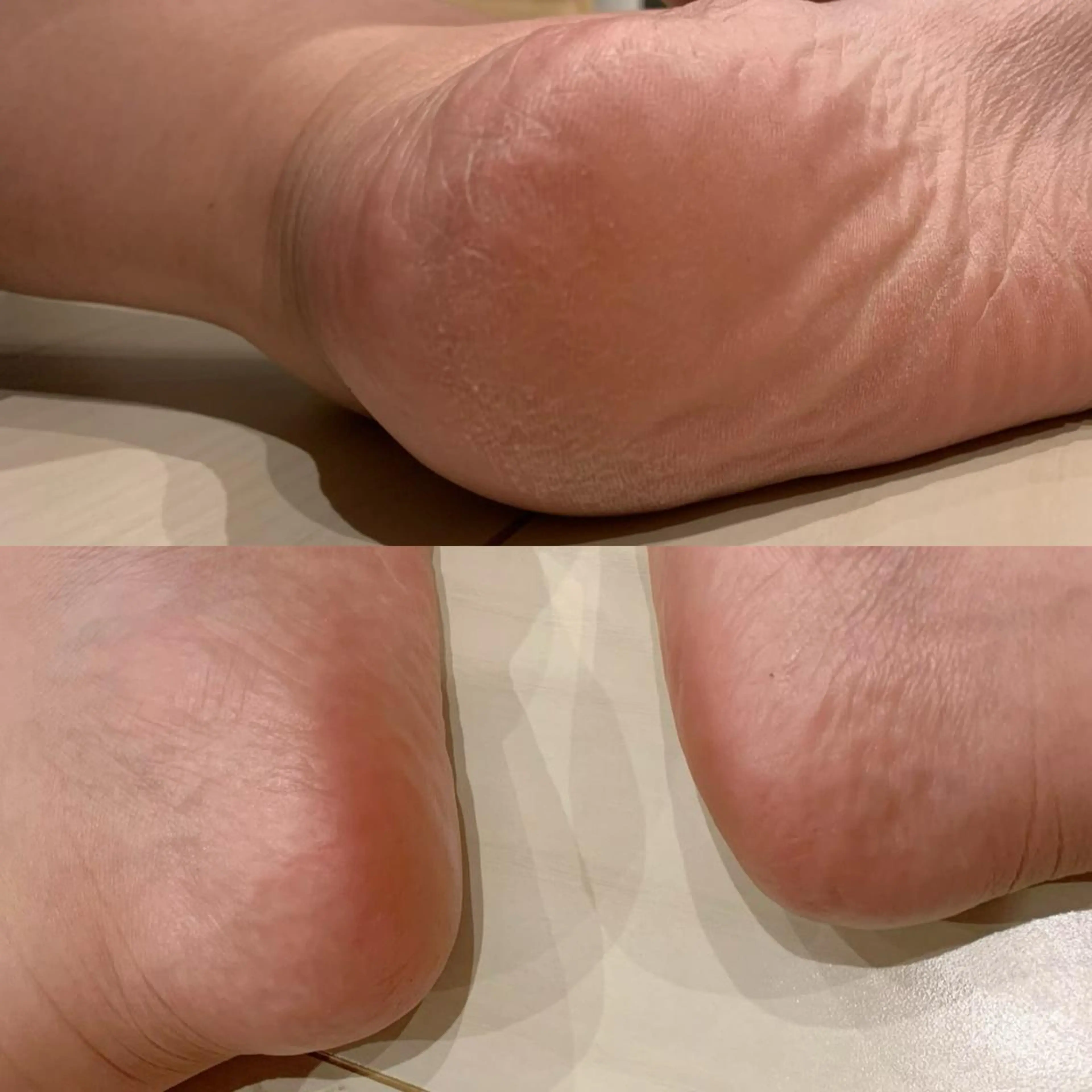 ネイル フットネイル その他(ネイル) SHIKI モリンガ蒸し/水光肌のエステ・リラクイメージ